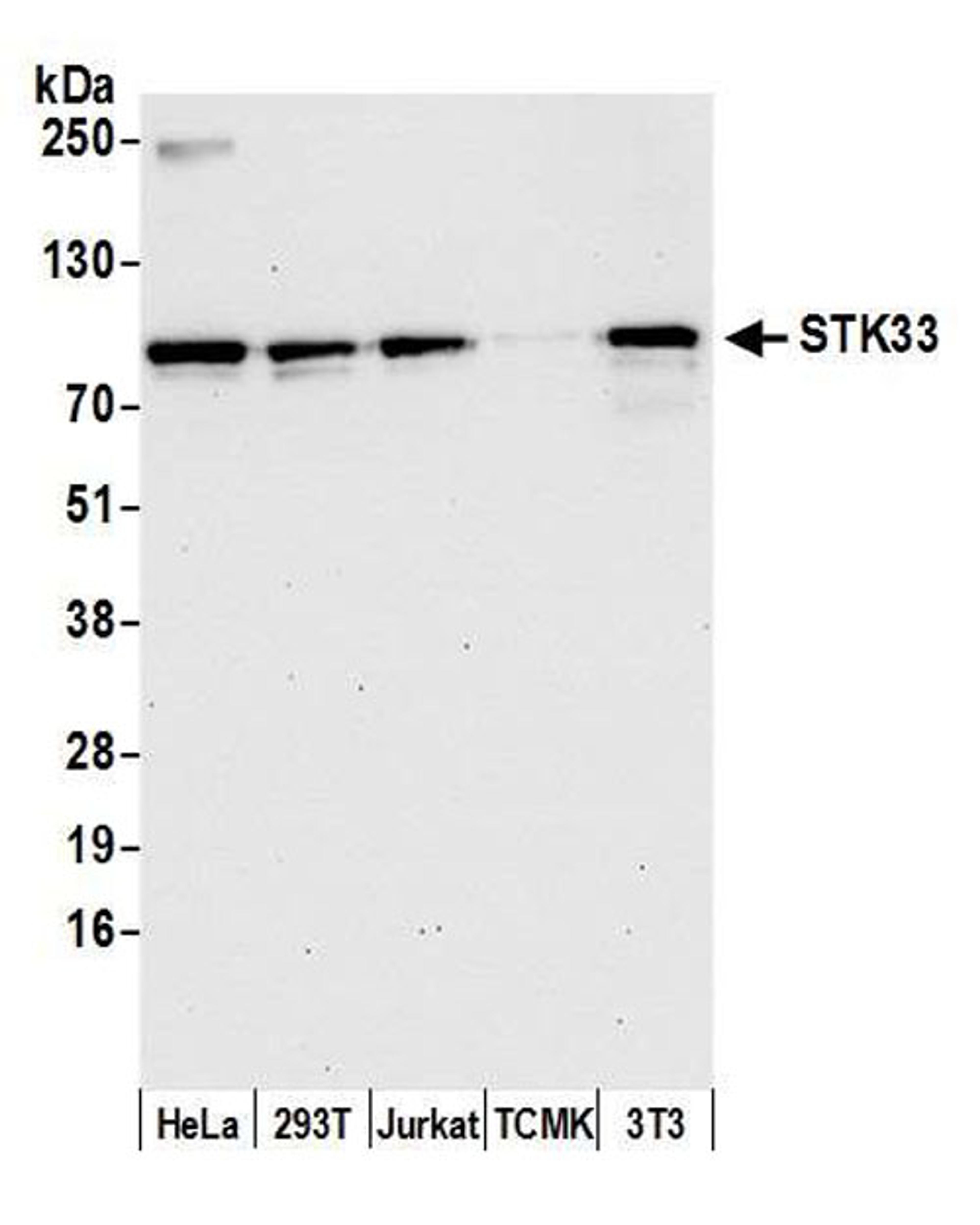 Detection of human and mouse STK33 by WB.