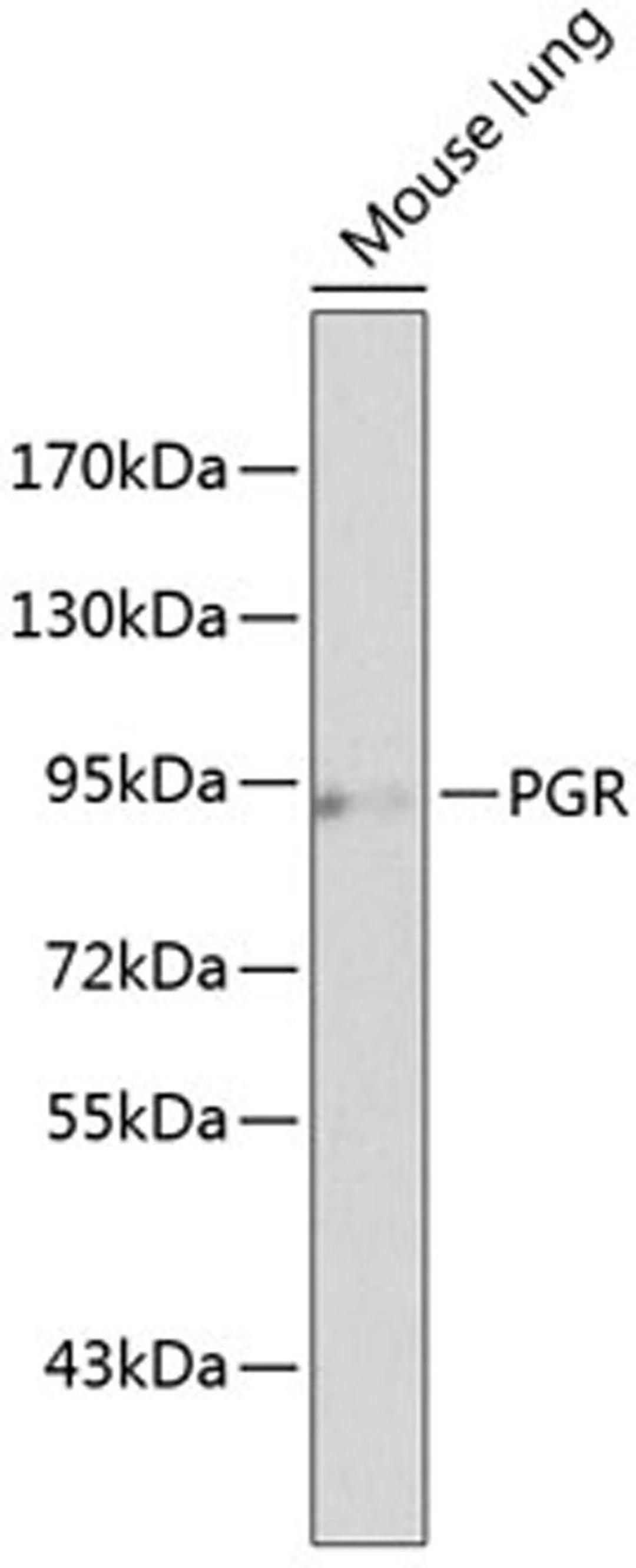 Western blot - PGR antibody (A2105)