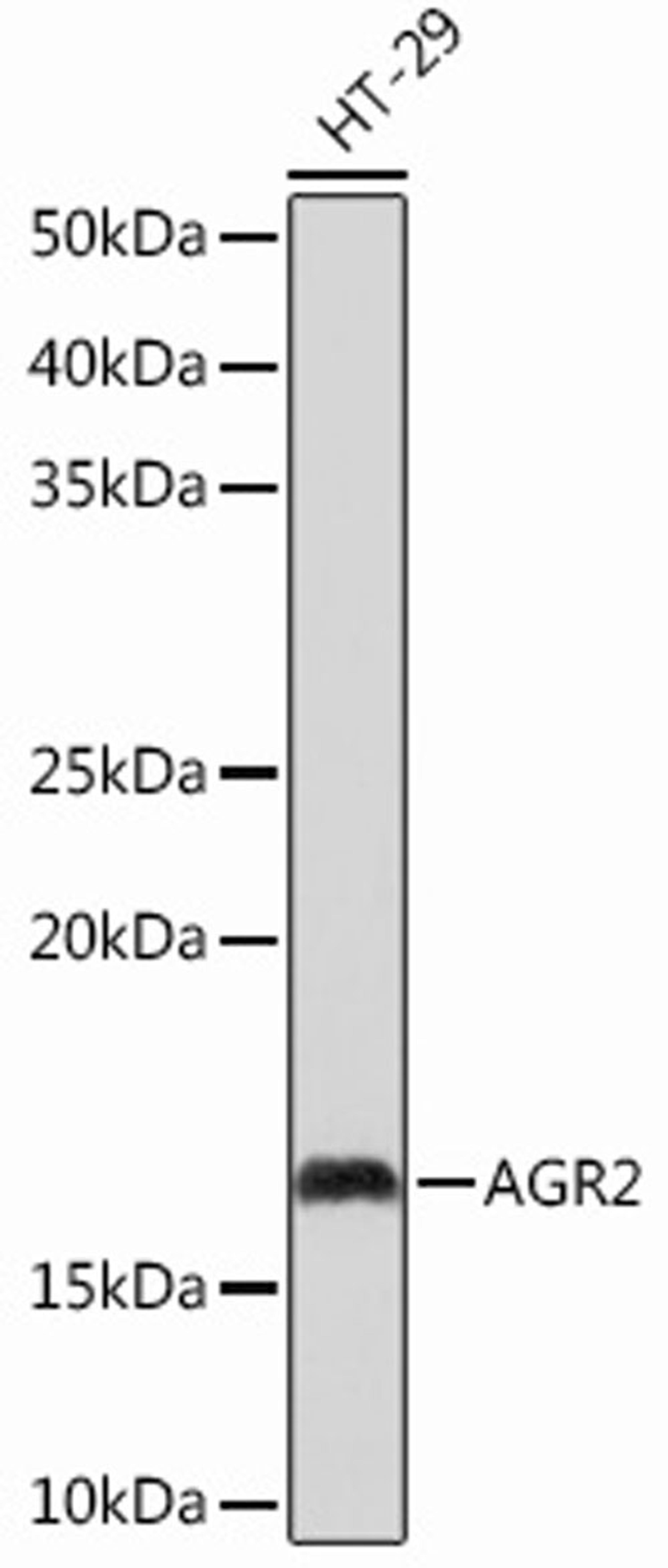 Western blot - AGR2 Rabbit mAb (A12411)