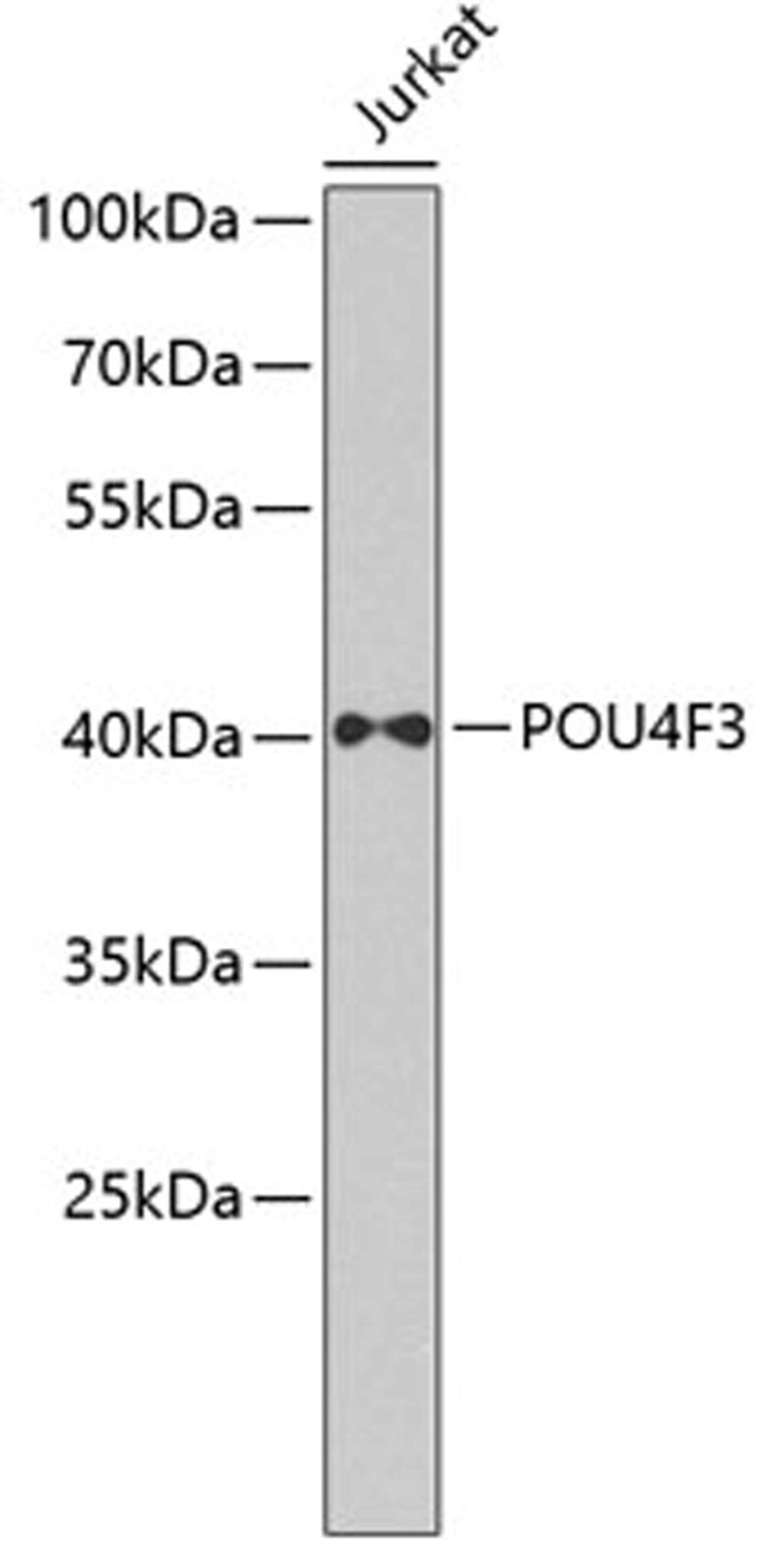 Western blot - POU4F3 antibody (A7712)