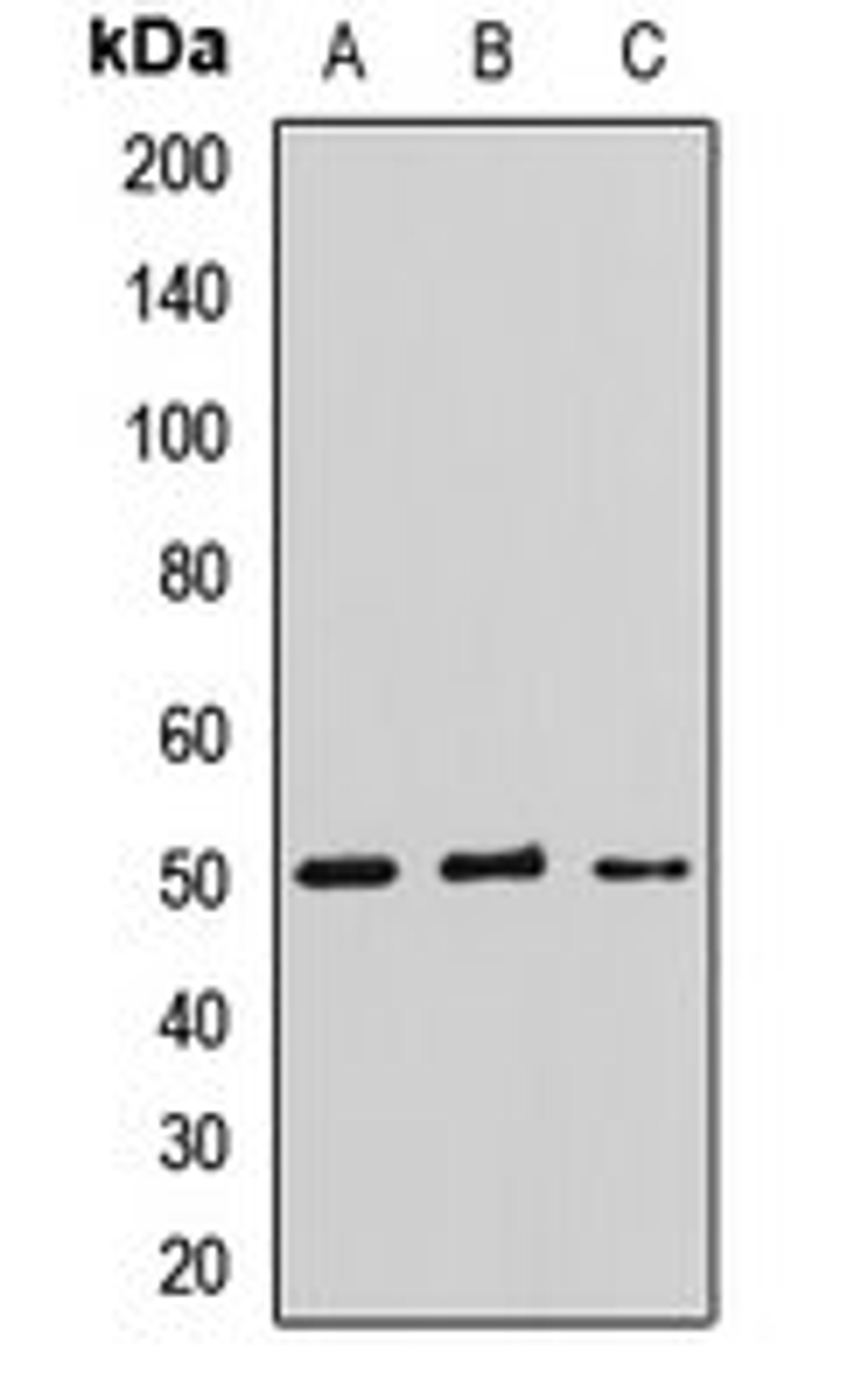 Western blot analysis of U87 (Lane1), mouse brain (Lane2), rat brain (Lane3) whole cell lysates using LHX9 antibody