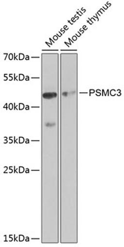 Western blot - PSMC3 antibody (A1986)