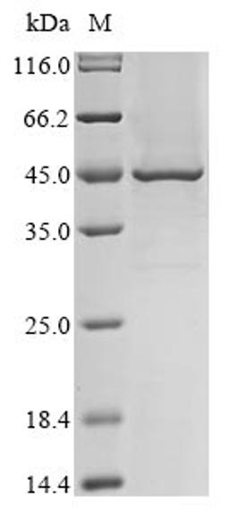 (Tris-Glycine gel) Discontinuous SDS-PAGE (reduced) with 5% enrichment gel and 15% separation gel.