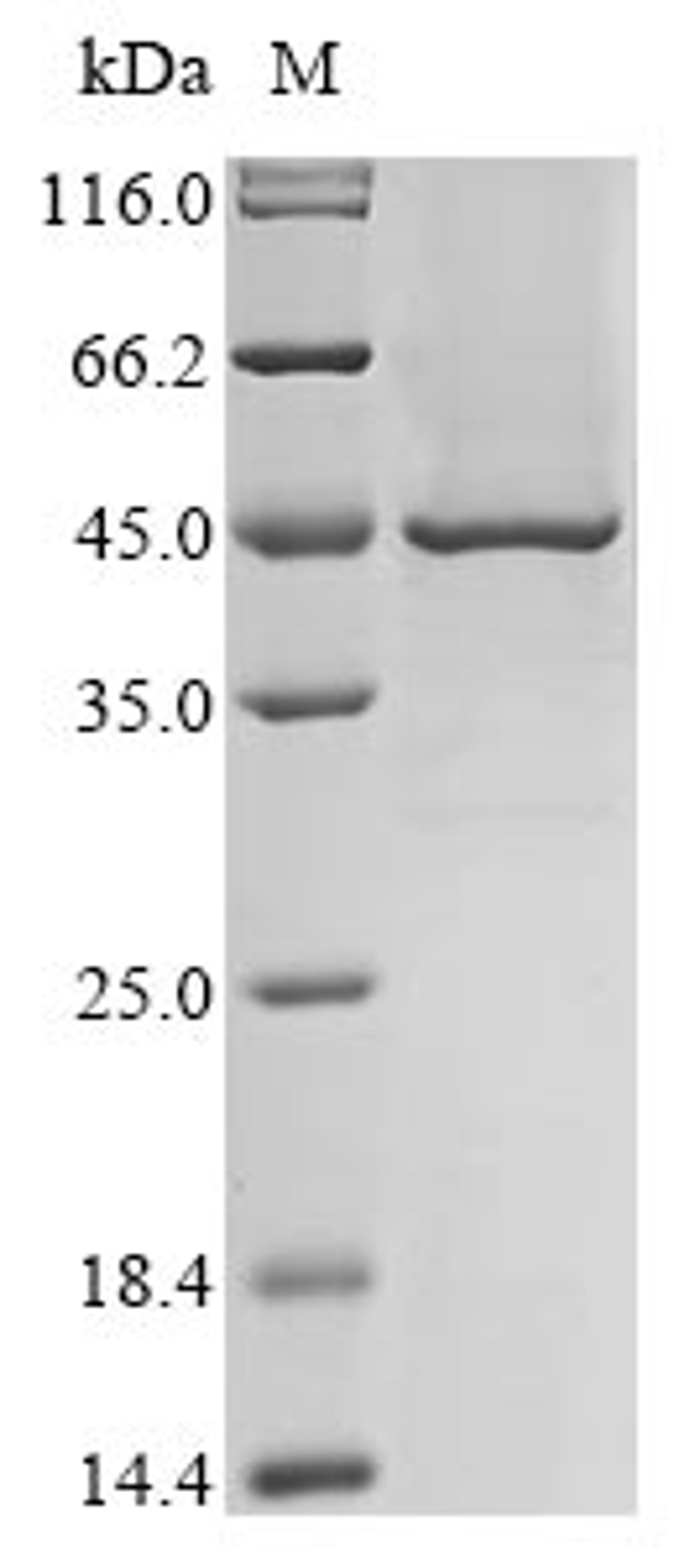 (Tris-Glycine gel) Discontinuous SDS-PAGE (reduced) with 5% enrichment gel and 15% separation gel.