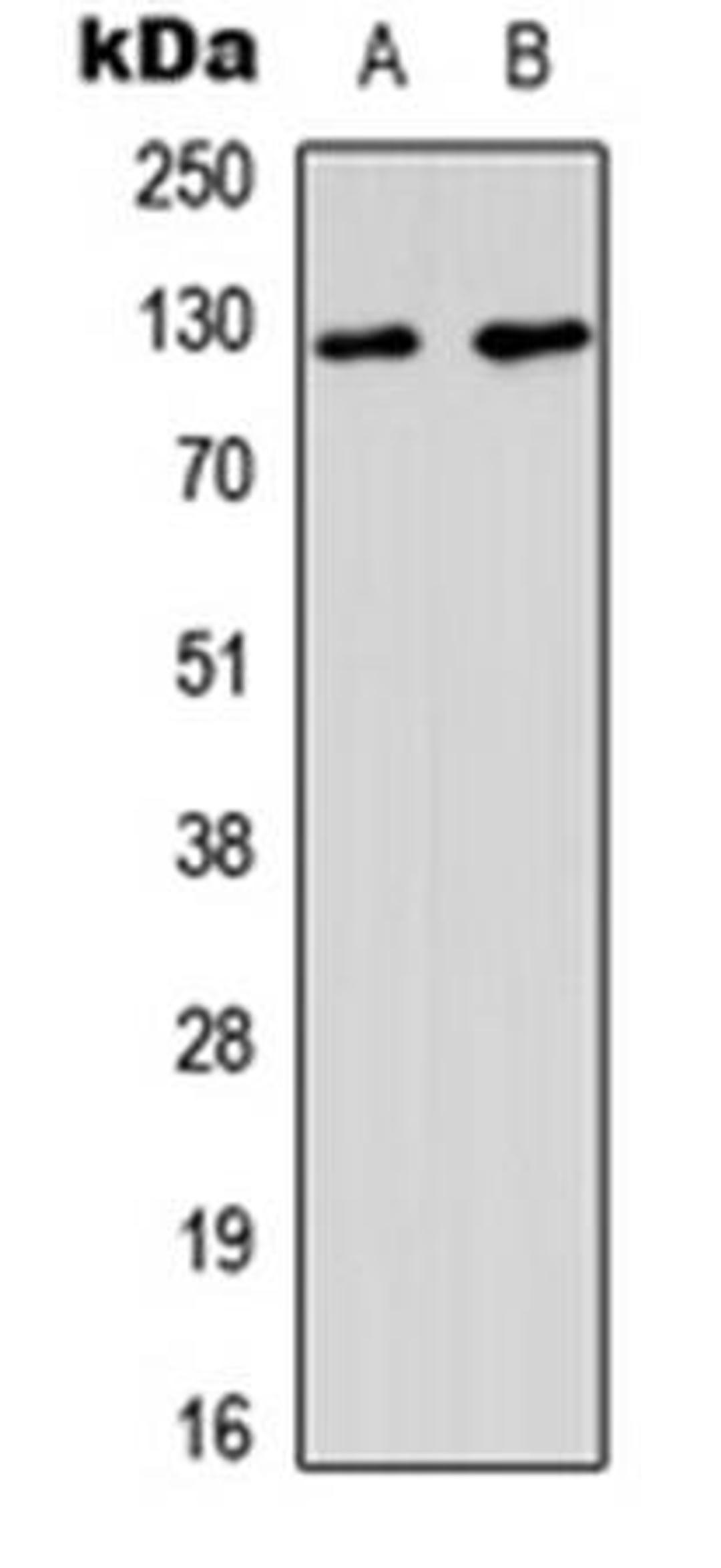 Western blot analysis of A549 (Lane1), HeLa (Lane2) whole cell using MSH3 antibody