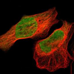 Immunocytochemistry/Immunofluorescence: EIF2B2 Antibody [NBP1-84877] - Staining of human cell line U-2 OS shows positivity in nucleus but not nucleoli & cytoplasm.