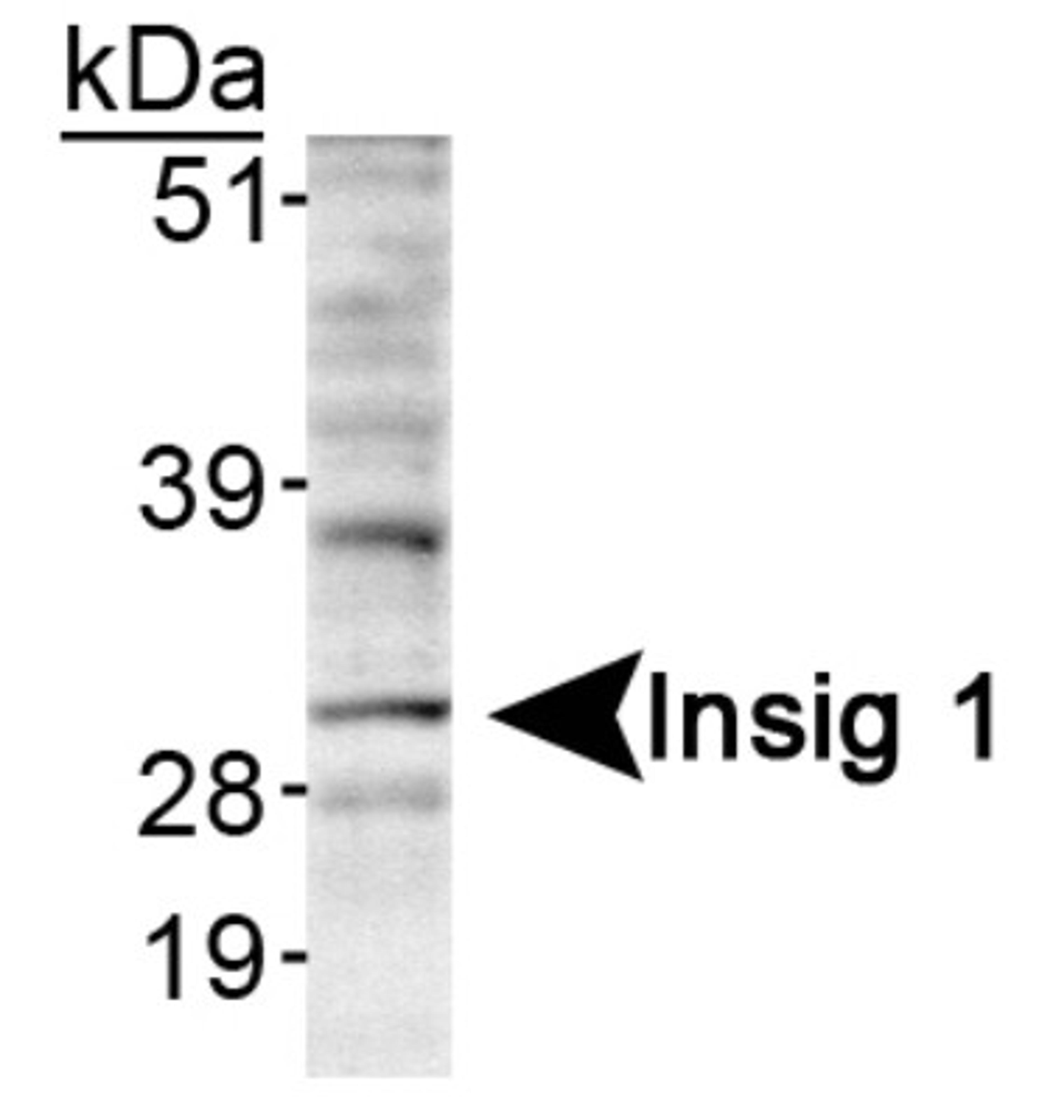 Western Blot: INSIG-1 Antibody [NB110-55244] - Detection of Insig 1 in HepG2 lyaste using NB110-55244.