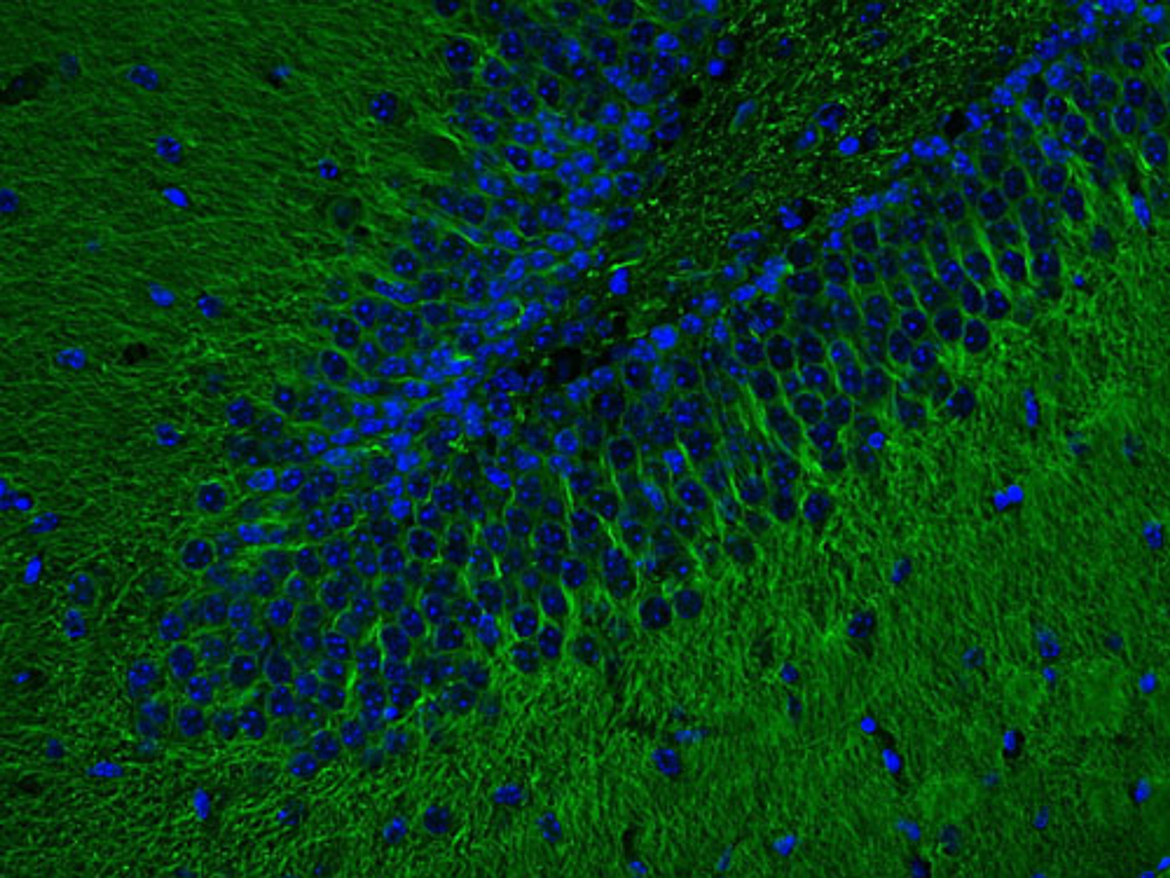 Mouse cerebellum section stained with chicken anti-MAP 2 and protag-HiSec anti-chicken IgY-X2 Sulfo-Cyanin 5 (Cy5)(Cat. No. 80410; green). Nuclei were stained using DAPI (blue)(courtesy of NanoTag Biotechnologies GmbH).