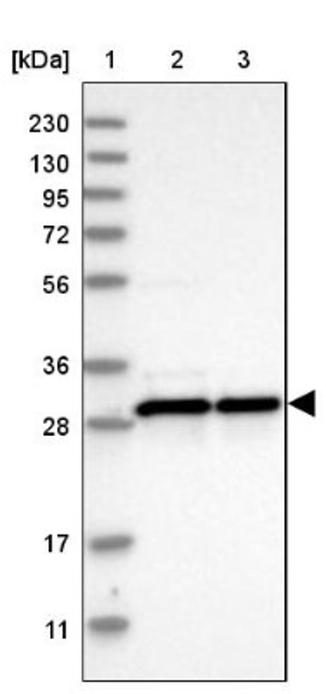 Western Blot: MRPL28 Antibody [NBP1-82805] - Lane 1: Marker [kDa] 230, 130, 95, 72, 56, 36, 28, 17, 11<br/>Lane 2: Human cell line RT-4<br/>Lane 3: Human cell line U-251MG sp