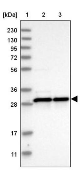 Western Blot: MRPL28 Antibody [NBP1-82805] - Lane 1: Marker [kDa] 230, 130, 95, 72, 56, 36, 28, 17, 11<br/>Lane 2: Human cell line RT-4<br/>Lane 3: Human cell line U-251MG sp