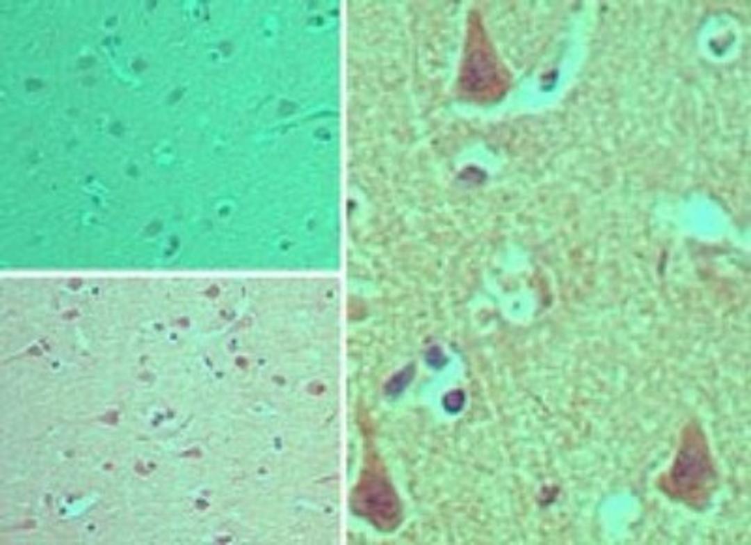 Immunohistochemistry-Paraffin: CENTD1 Antibody [NBP2-24620] - Staining of human brain tissue using an isotype control (top left) and (bottom left, right) at 5 ug/ml.