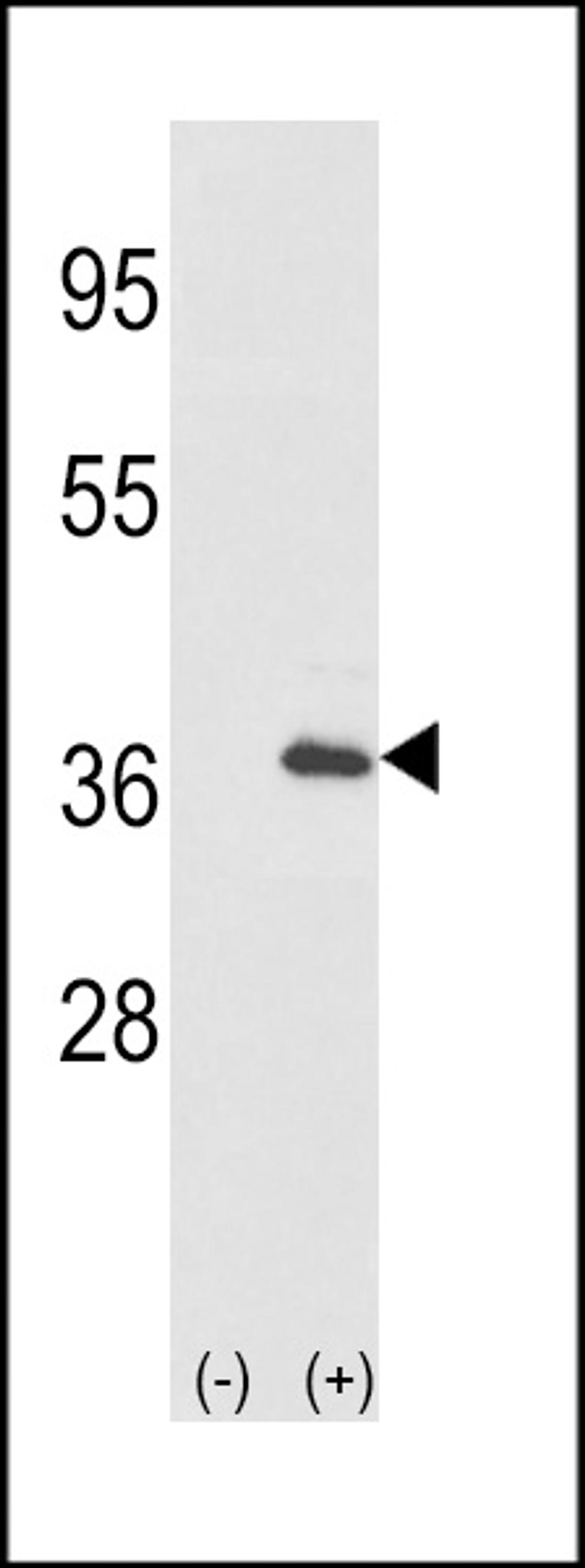 Western blot analysis of IL1A using rabbit polyclonal IL1A-pS87 using 293 cell lysates (2 ug/lane) either nontransfected (Lane 1) or transiently transfected with the IL1A gene (Lane 2).