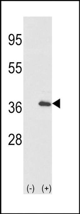 Western blot analysis of IL1A using rabbit polyclonal IL1A-pS87 using 293 cell lysates (2 ug/lane) either nontransfected (Lane 1) or transiently transfected with the IL1A gene (Lane 2).