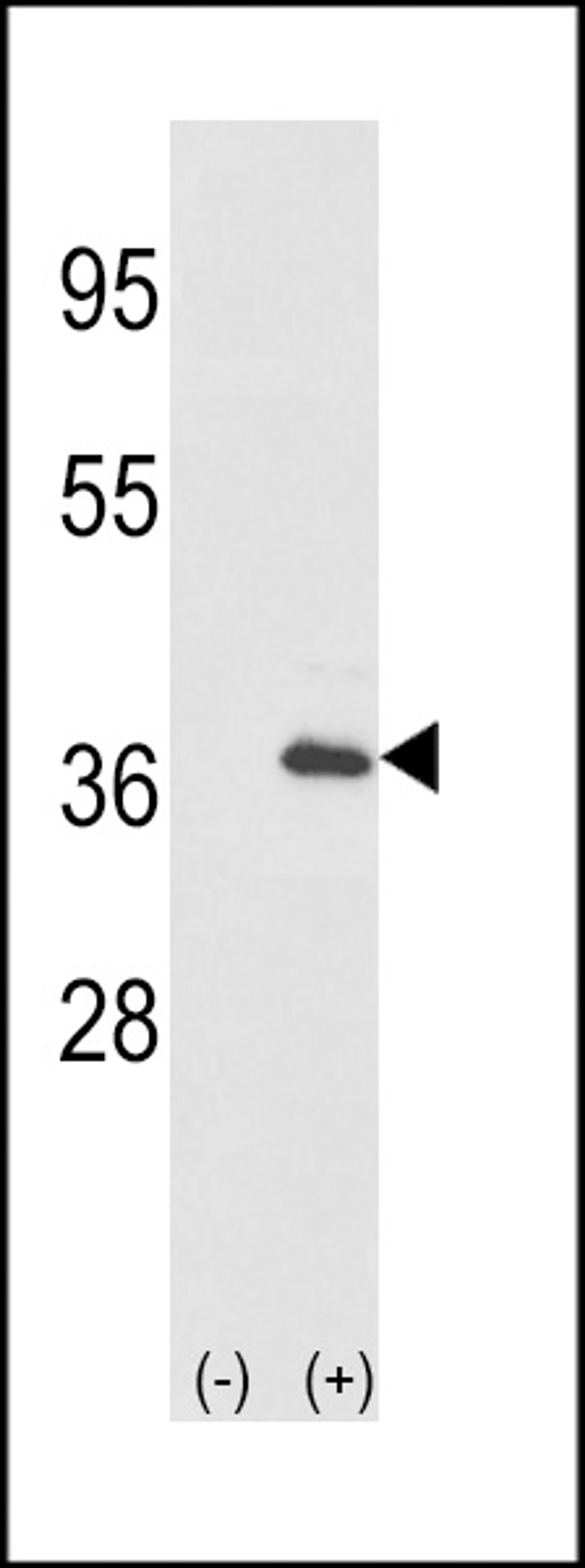 Western blot analysis of IL1A using rabbit polyclonal IL1A-pS87 using 293 cell lysates (2 ug/lane) either nontransfected (Lane 1) or transiently transfected with the IL1A gene (Lane 2).