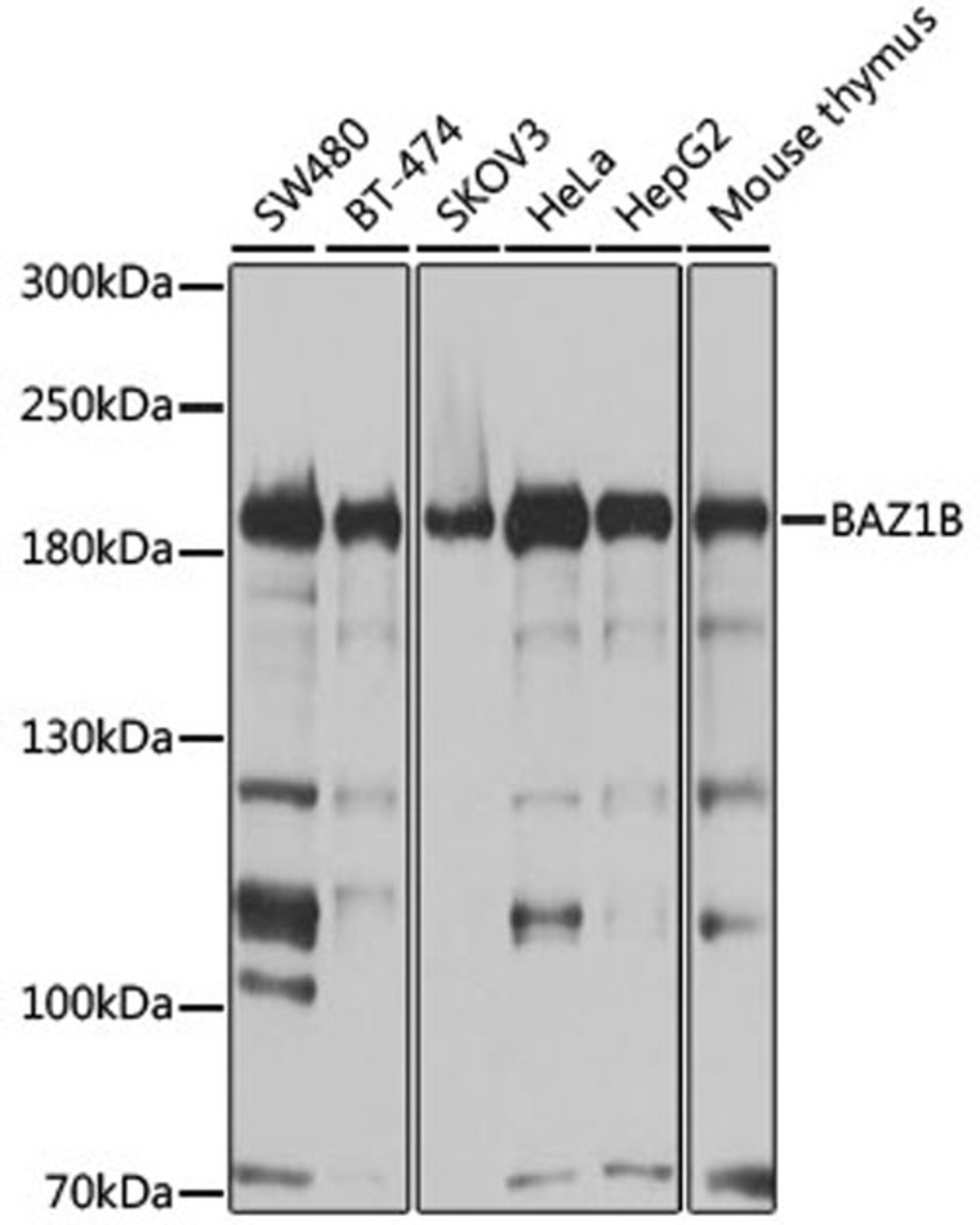 Western blot - BAZ1B antibody (A9851)