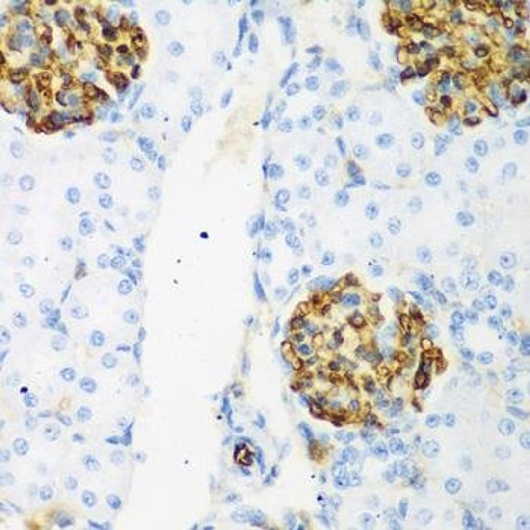 Immunohistochemical staining of rat kidney tissue using CSRNP1 antibody (dilution of 1:200)