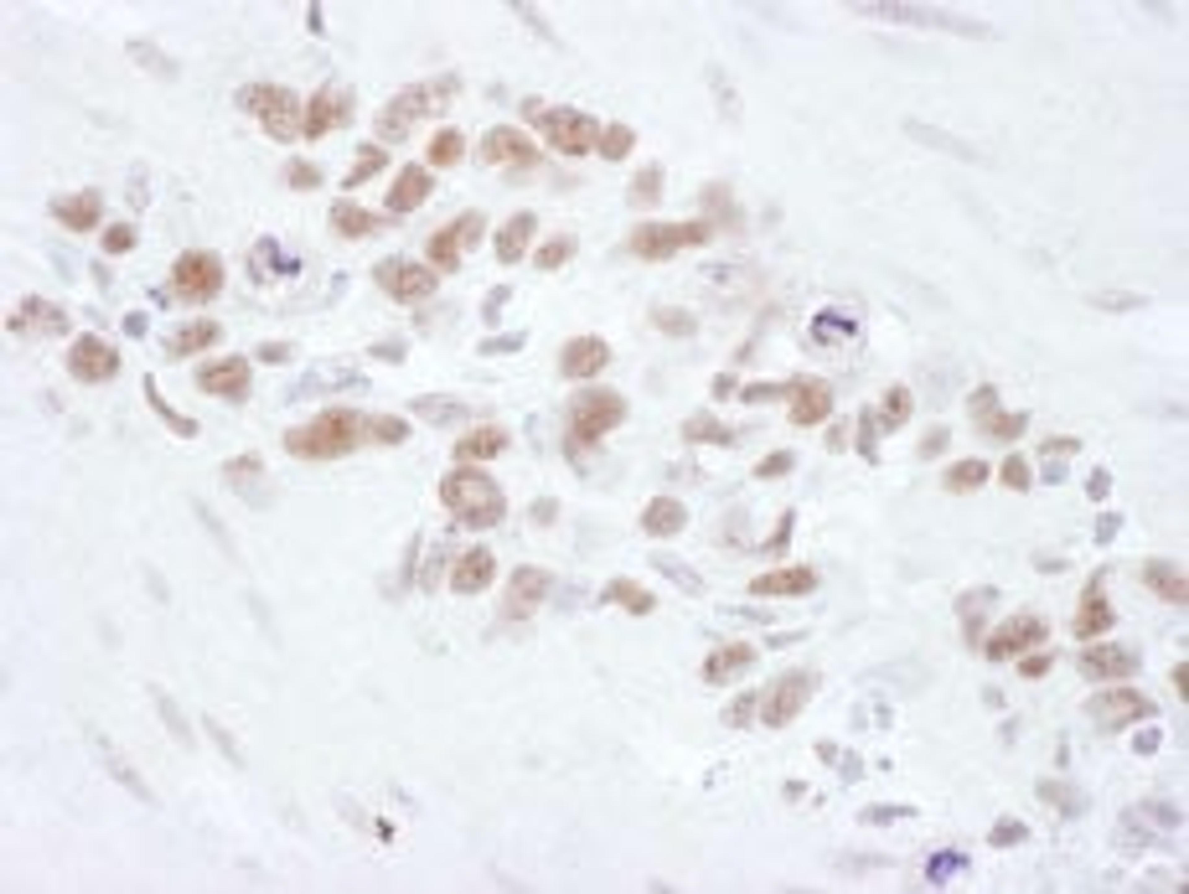 Detection of human Mre11 by immunohistochemistry.