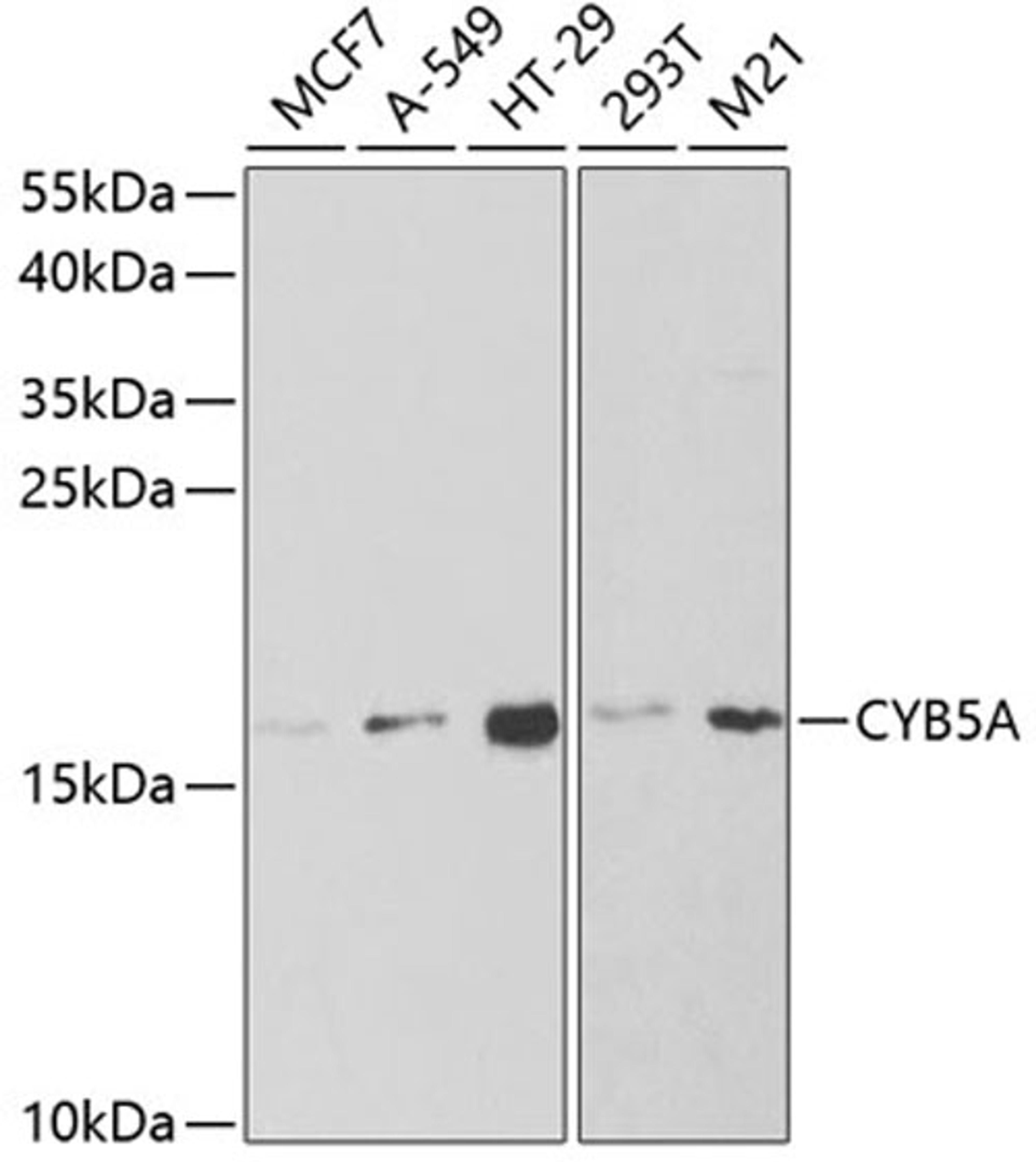 Western blot - CYB5A antibody (A5401)