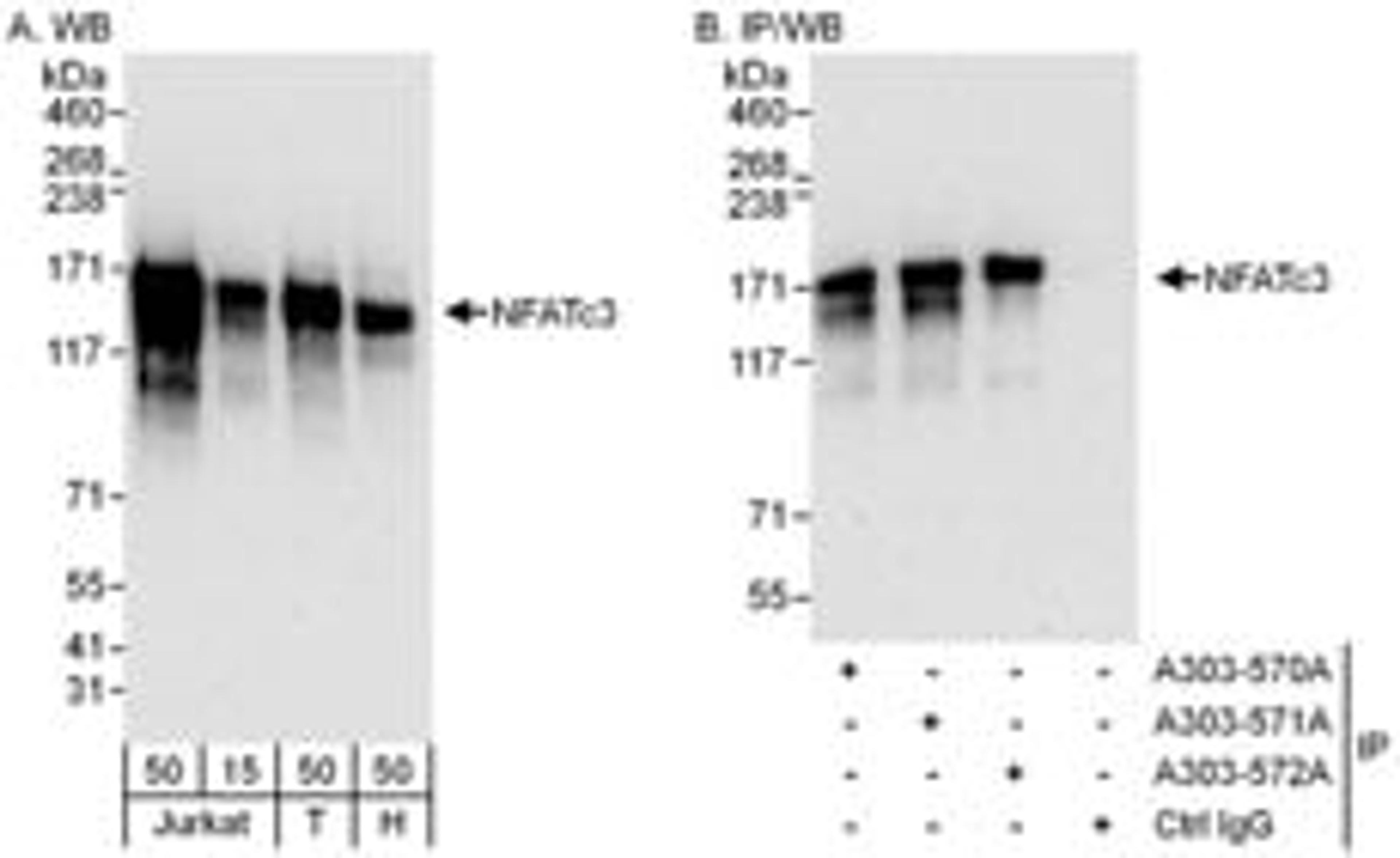 Detection of human NFATc3 by western blot and immunoprecipitation.