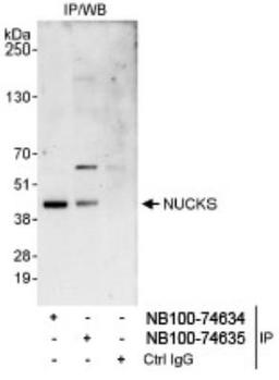 Immunoprecipitation: NUCKS1 Antibody [NB100-74634] - Detection of Human NUCKS by Western Blot of  Immunoprecipitates. Samples: Whole cell lysate (1 mg for IP,  20% of IP loaded) from HeLa cells. Antibodies: Affinity purified  rabbit anti-NUCKS antibody NB100-74634 used for IP at 3  mcg/mg lysate. NUCKS was also immunoprecipitated by rabbit  anti-NUCKS antibody NB100-74635, which recognizes a  downstream epitope. Detection: Chemiluminescence with an exposure time of 30  seconds.