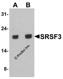 Western blot analysis of SRSF3 in K562 cell lysate with SRSF3 antibody at (A) 1 and (B) 2 μg/ml.