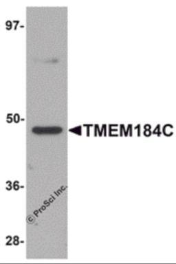 Western blot analysis of TMEM184C in mouse heart tissue lysate with TMEM184C antibody at 1 &#956;g/mL.