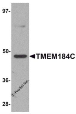 Western blot analysis of TMEM184C in mouse heart tissue lysate with TMEM184C antibody at 1 μg/mL.