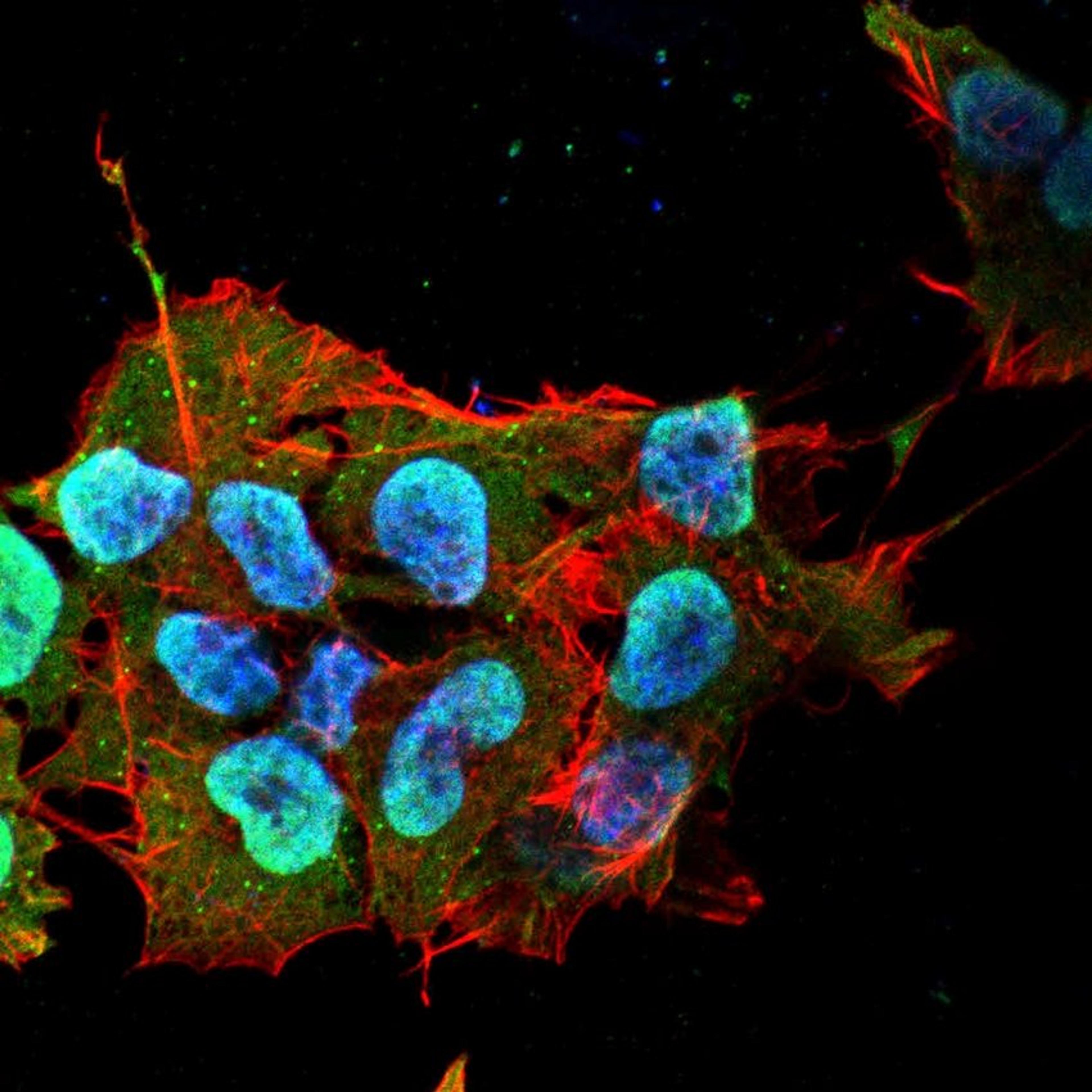 Immunofluorescence analysis of neuroblastoma cell line sk-n-be using Ataxin 1 antibody