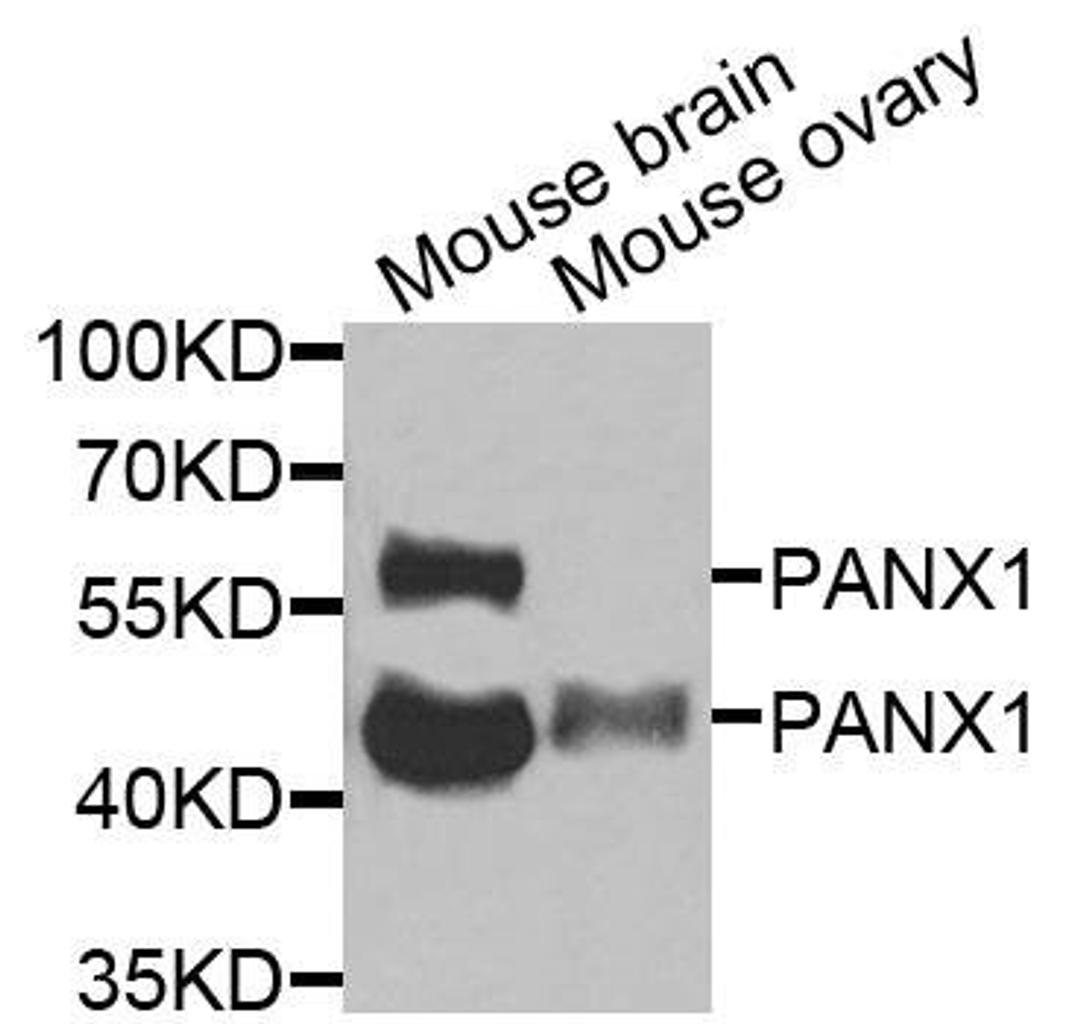 Western blot analysis of extracts of various cells using PANX1 antibody