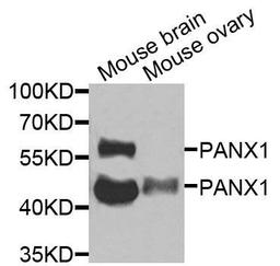 Western blot analysis of extracts of various cells using PANX1 antibody