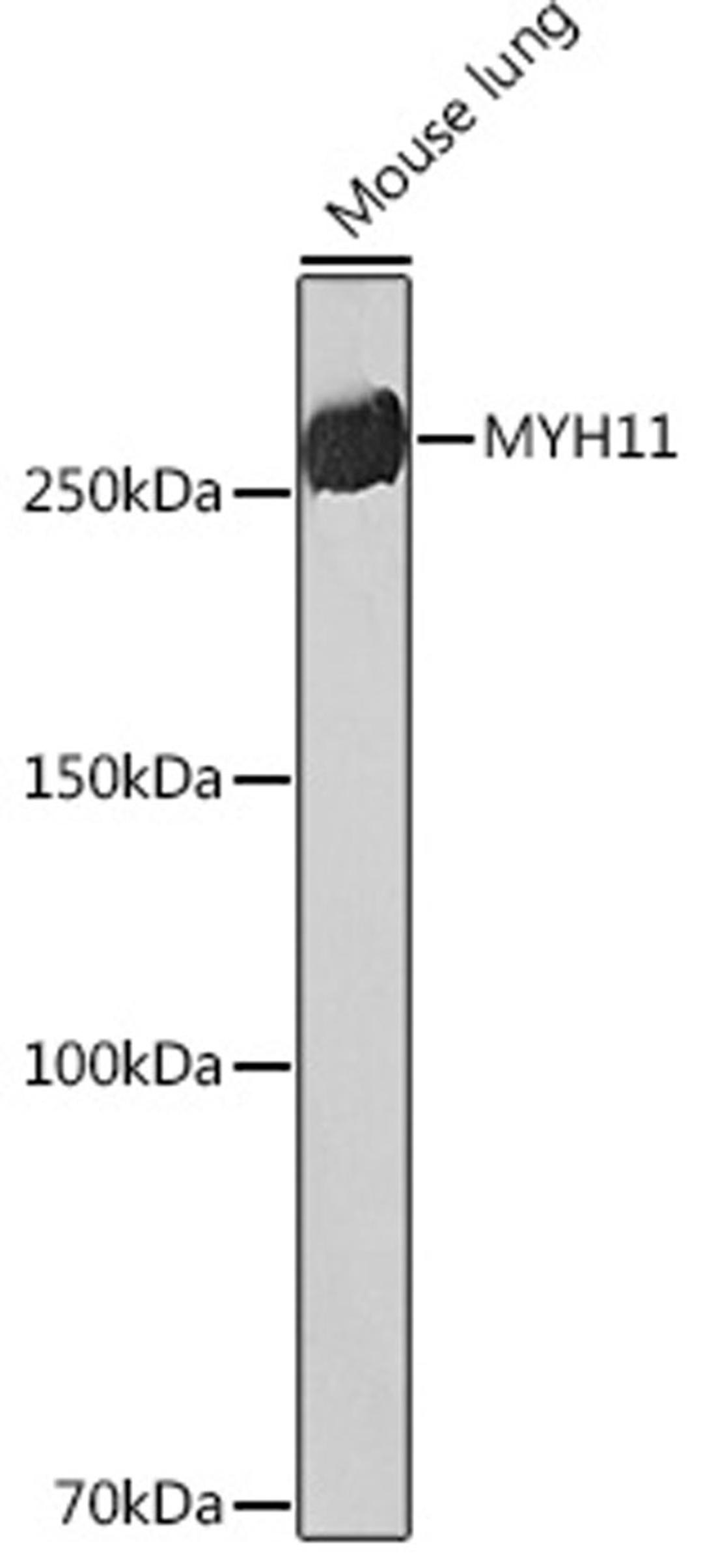 Western blot - MYH11 Rabbit mAb (A4064)