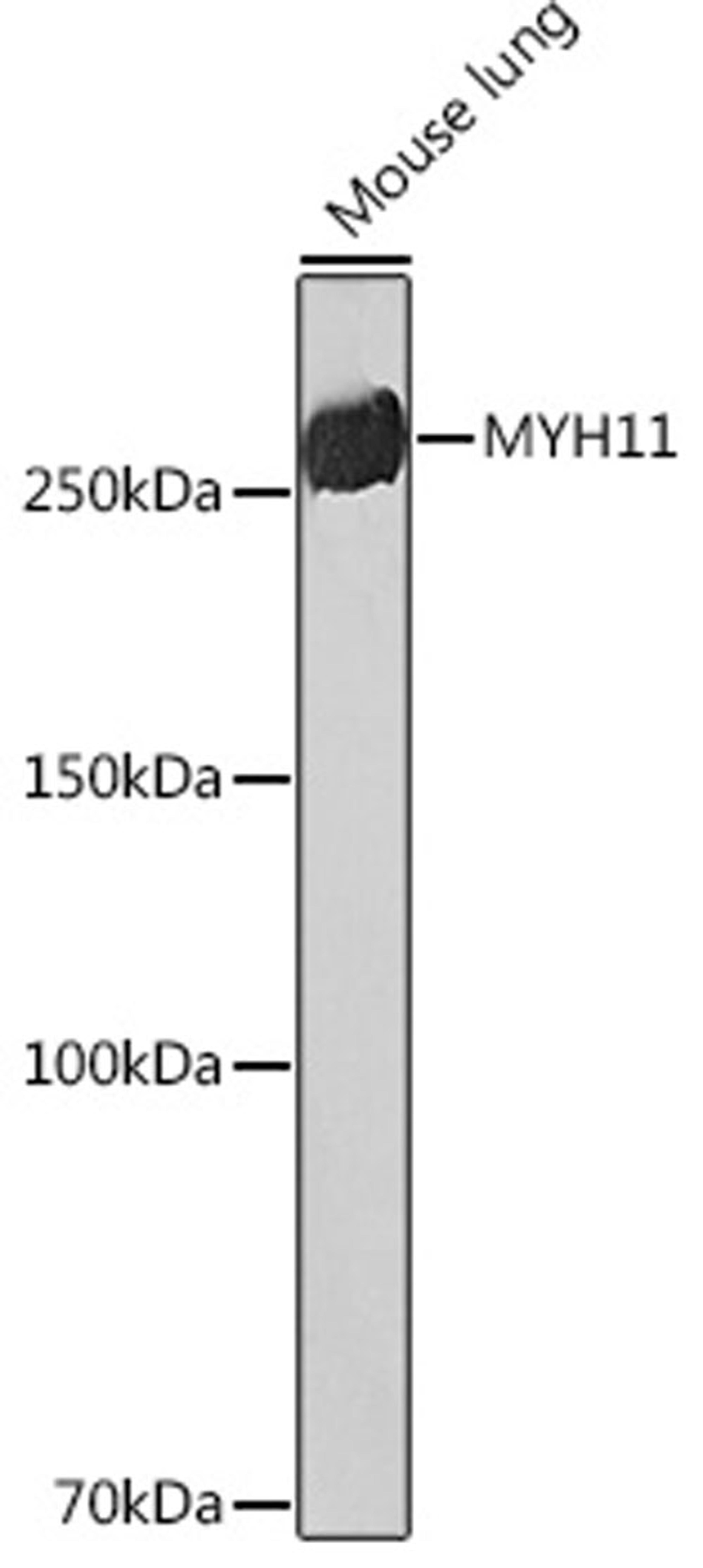 Western blot - MYH11 Rabbit mAb (A4064)