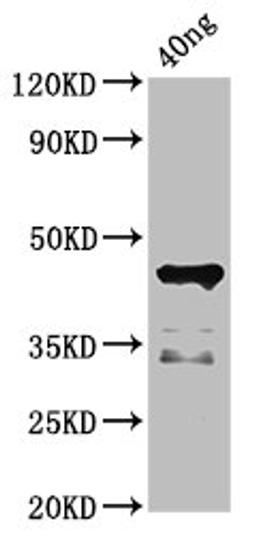 Western Blot. Positive WB detected in Recombinant protein. All lanes: ligA antibody at 4.5ug/ml. Secondary. Goat polyclonal to rabbit IgG at 1/50000 dilution. Predicted band size: 45 kDa. Observed band size: 45 kDa.