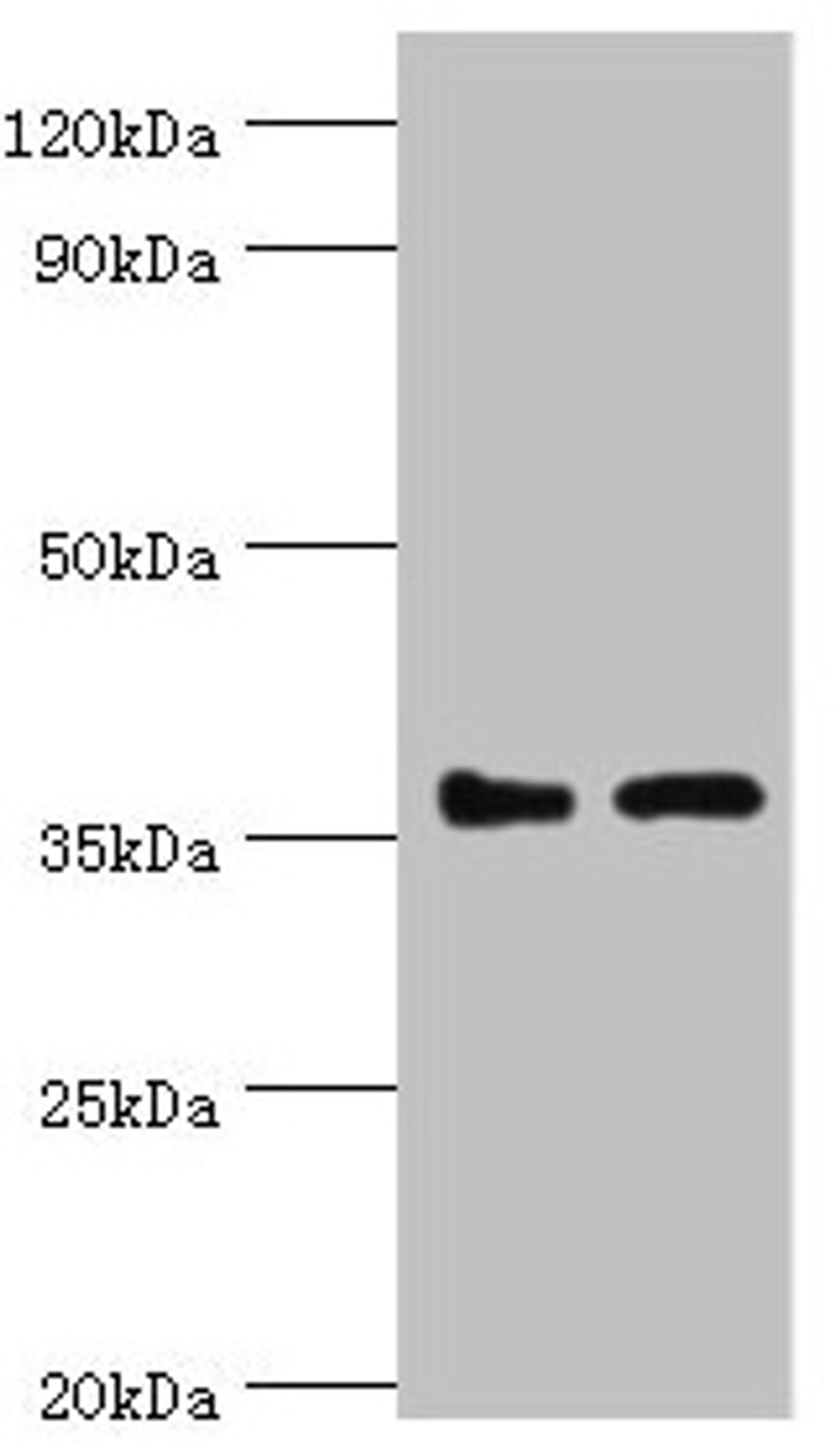 Western blot. All lanes: BRCC3 antibody at 3ug/ml. Lane 1: 293T whole cell lysate. Lane 2: MCF-7 whole cell lysate. Secondary. Goat polyclonal to rabbit IgG at 1/10000 dilution. Predicted band size: 37, 34, 24, 29 kDa. Observed band size: 37 kDa.
