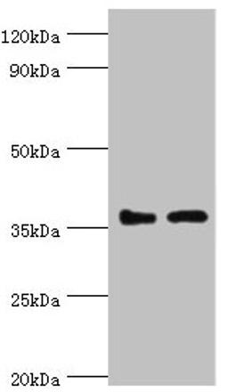 Western blot. All lanes: BRCC3 antibody at 3ug/ml. Lane 1: 293T whole cell lysate. Lane 2: MCF-7 whole cell lysate. Secondary. Goat polyclonal to rabbit IgG at 1/10000 dilution. Predicted band size: 37, 34, 24, 29 kDa. Observed band size: 37 kDa.