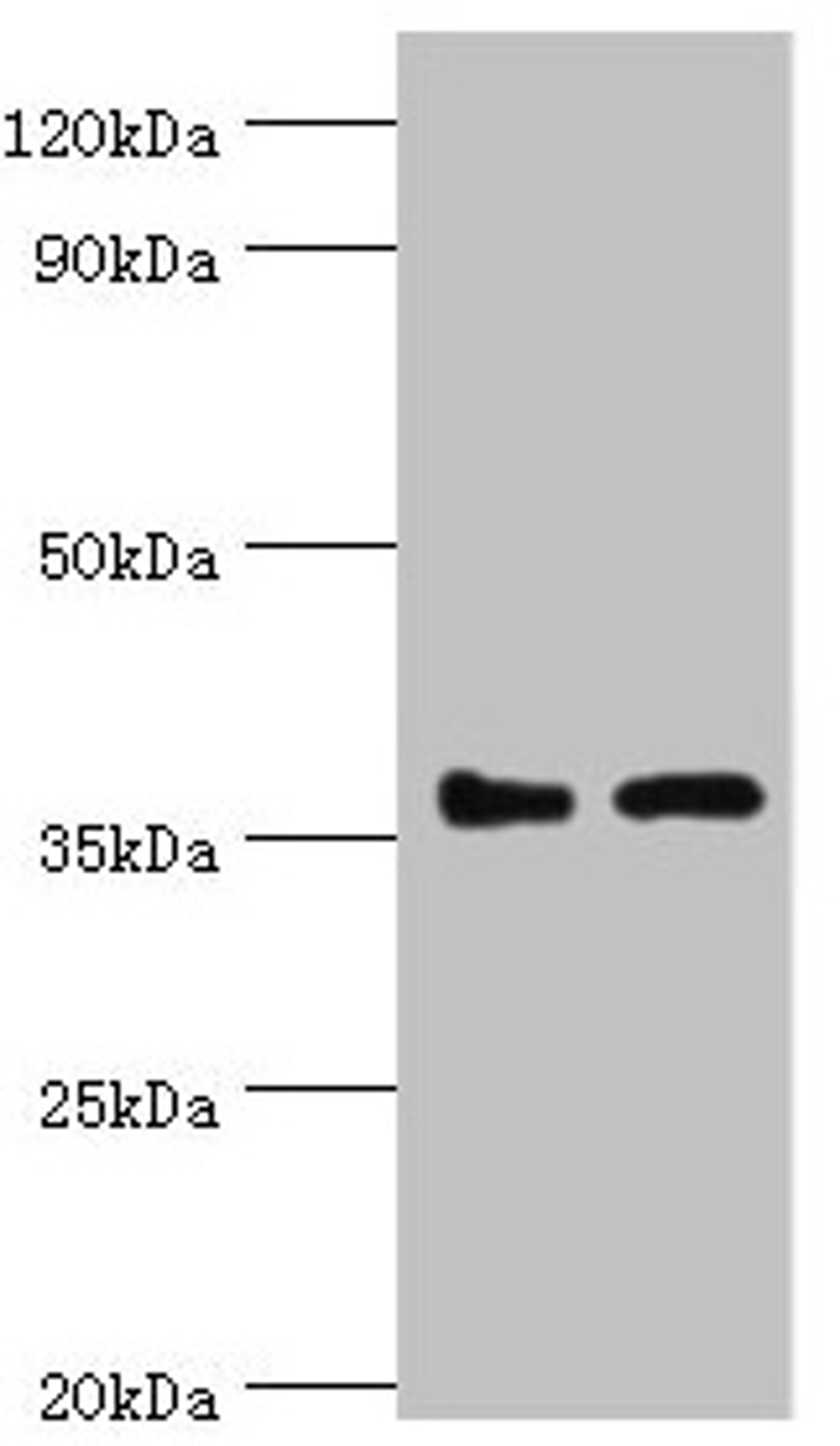 Western blot. All lanes: BRCC3 antibody at 3ug/ml. Lane 1: 293T whole cell lysate. Lane 2: MCF-7 whole cell lysate. Secondary. Goat polyclonal to rabbit IgG at 1/10000 dilution. Predicted band size: 37, 34, 24, 29 kDa. Observed band size: 37 kDa.