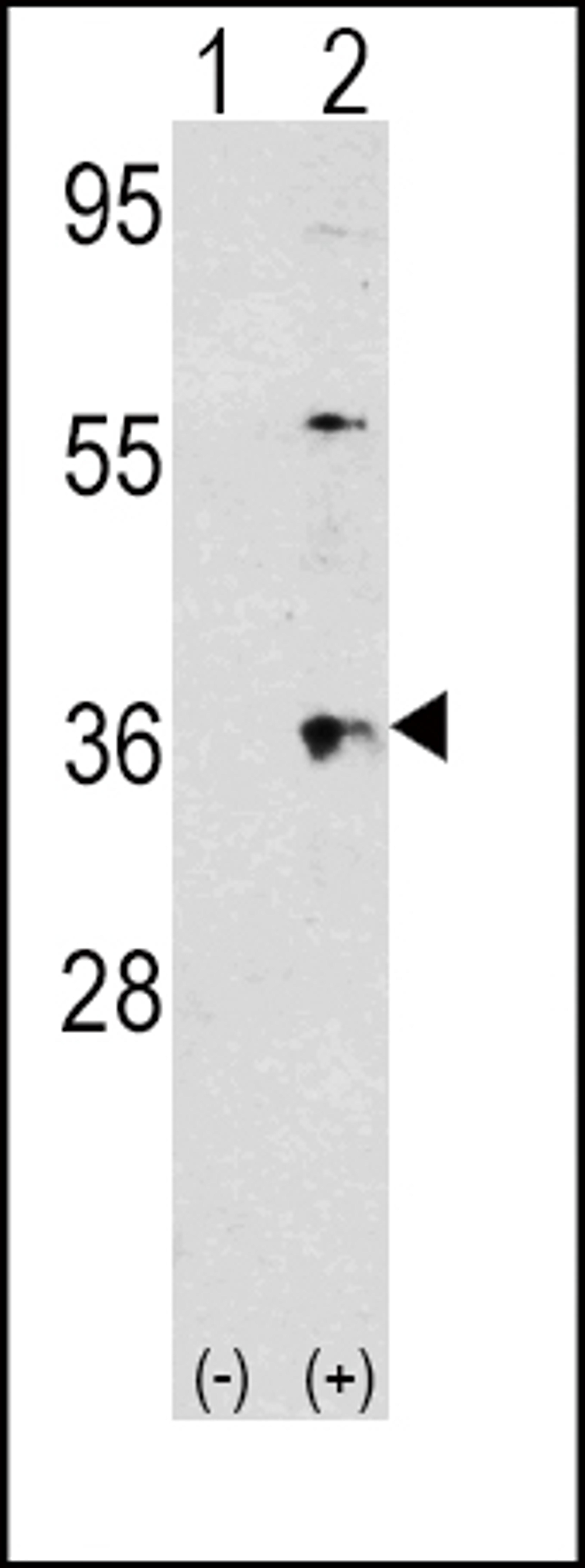 Western blot analysis of THPO using rabbit polyclonal THPO Antibody using 293 cell lysates (2 ug/lane) either nontransfected (Lane 1) or transiently transfected with the THPO gene (Lane 2).