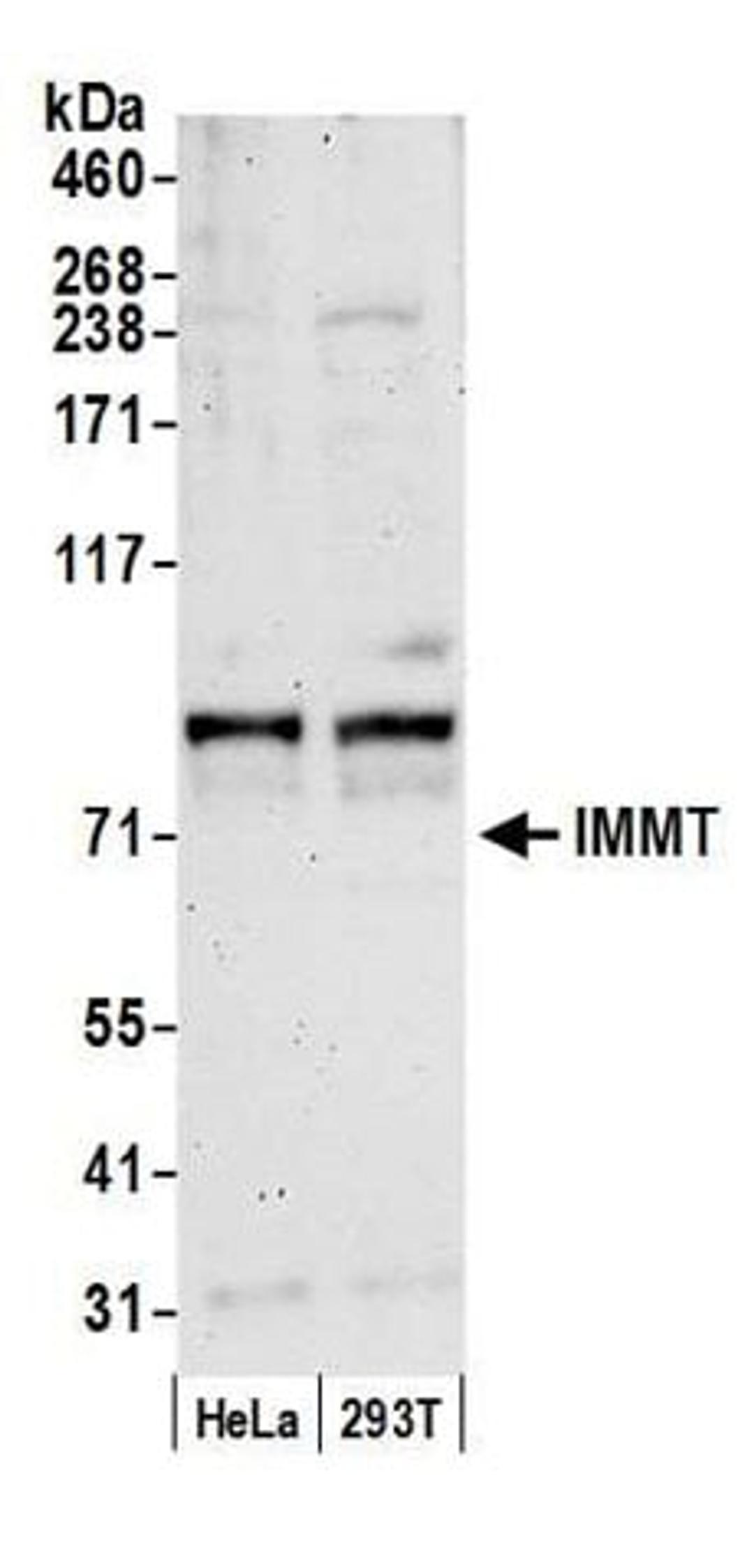 Detection of human IMMT by western blot.