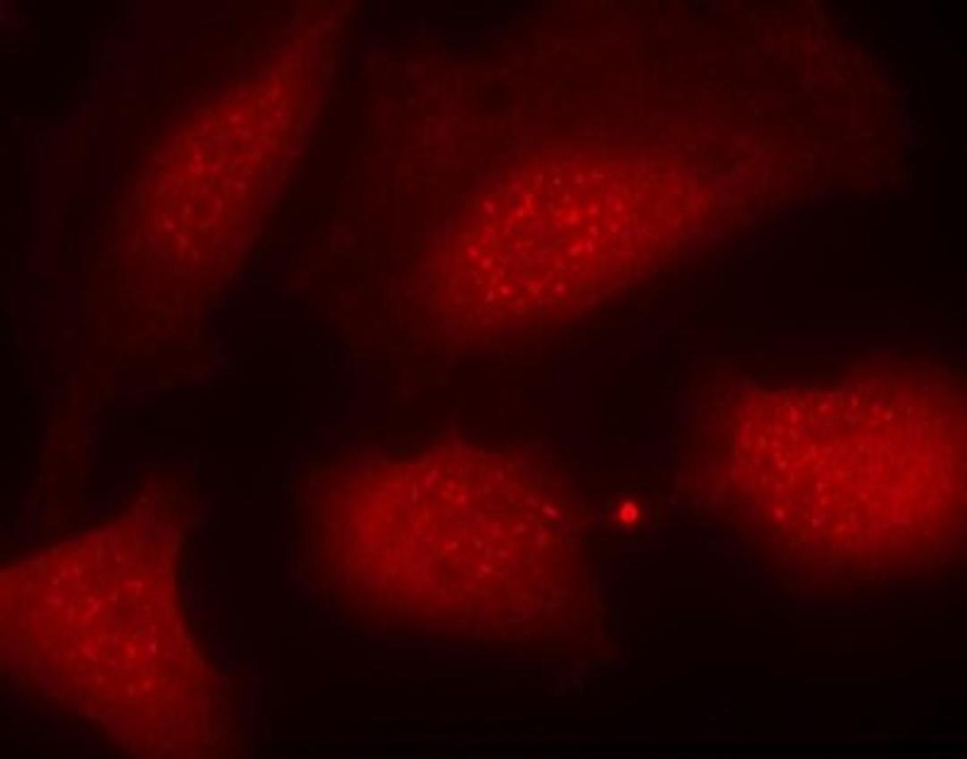 Immunocytochemistry/Immunofluorescence: Histone H3.1 [p Ser10] Antibody [NB100-81965] - Staining of methanol-fixed Hela cells using Histone H3.1(Phospho-Ser10) antibody