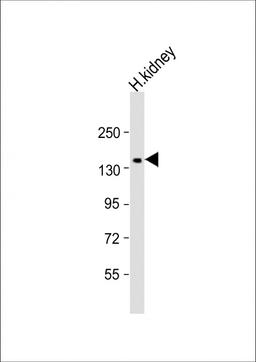 Western Blot at 1:1000 dilution + kidney lysate Lysates/proteins at 20 ug per lane.