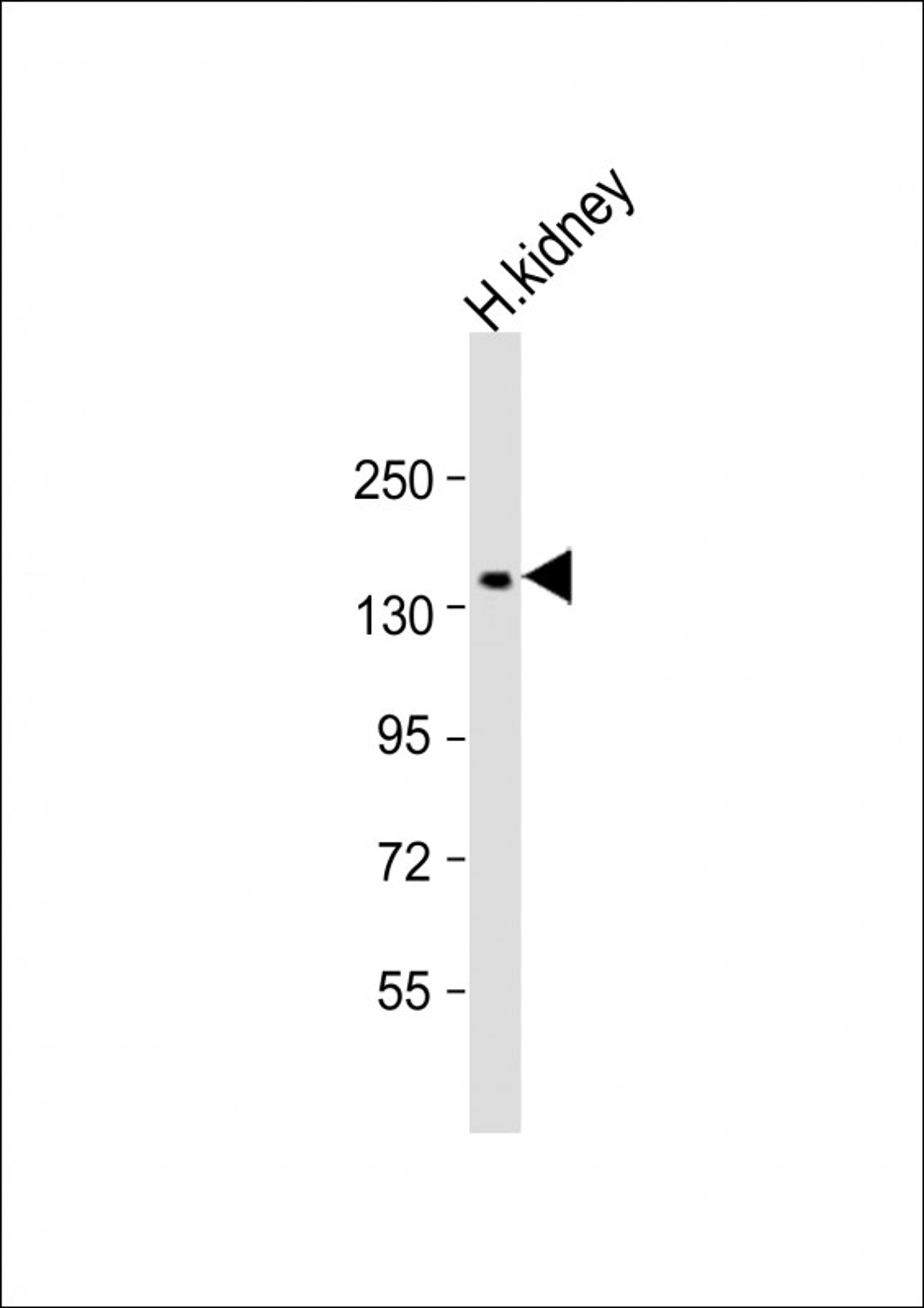 Western Blot at 1:1000 dilution + kidney lysate Lysates/proteins at 20 ug per lane.