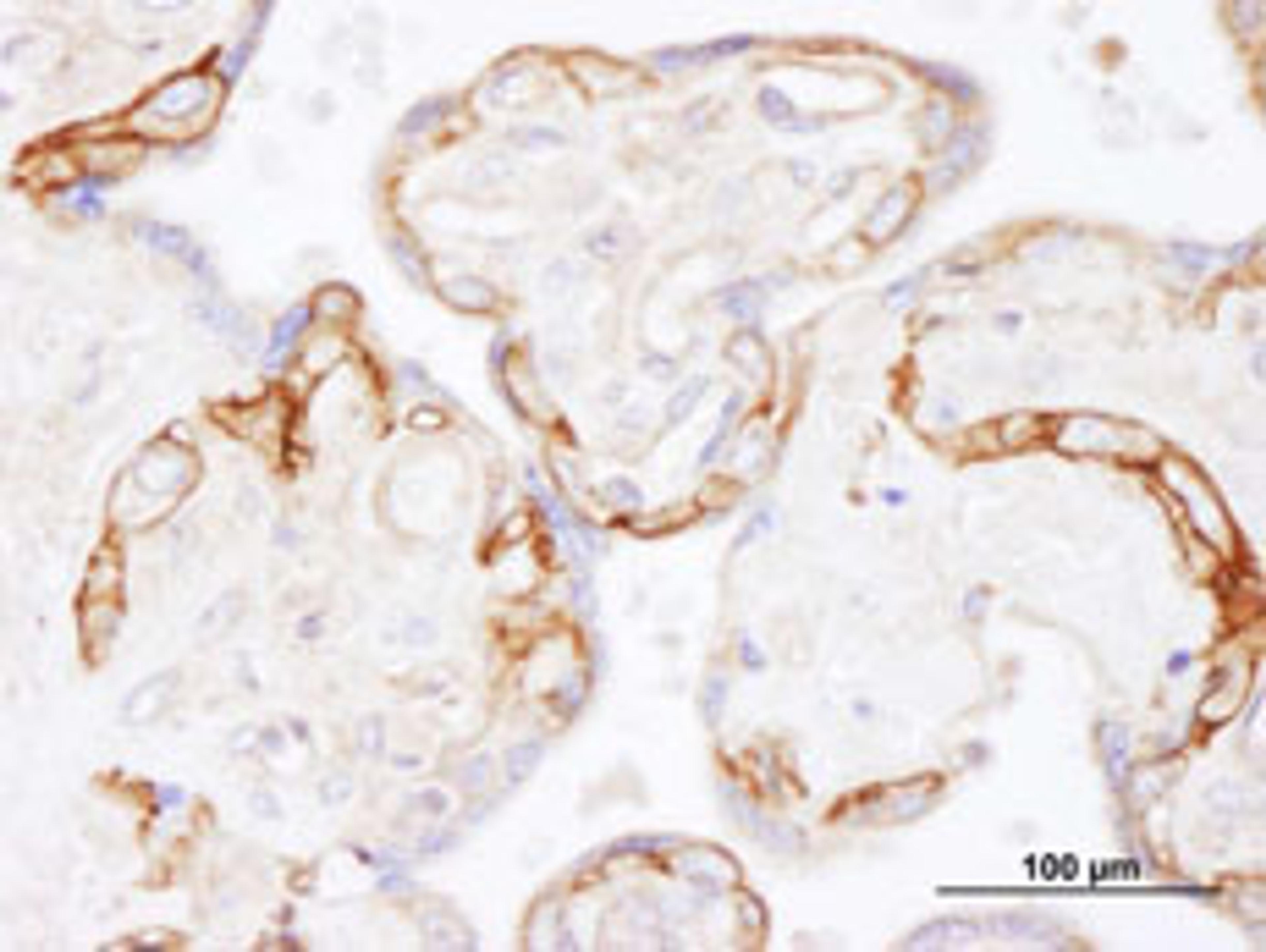 Detection of human EGFR by immunohistochemistry.