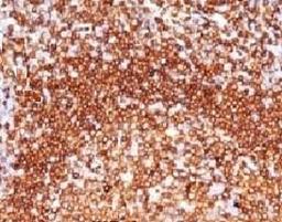 IHC testing of human tonsil and CD79a antibody (CDLA79a-1).