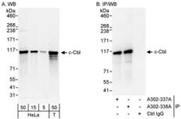 Detection of human c-Cbl by western blot and immunoprecipitation.