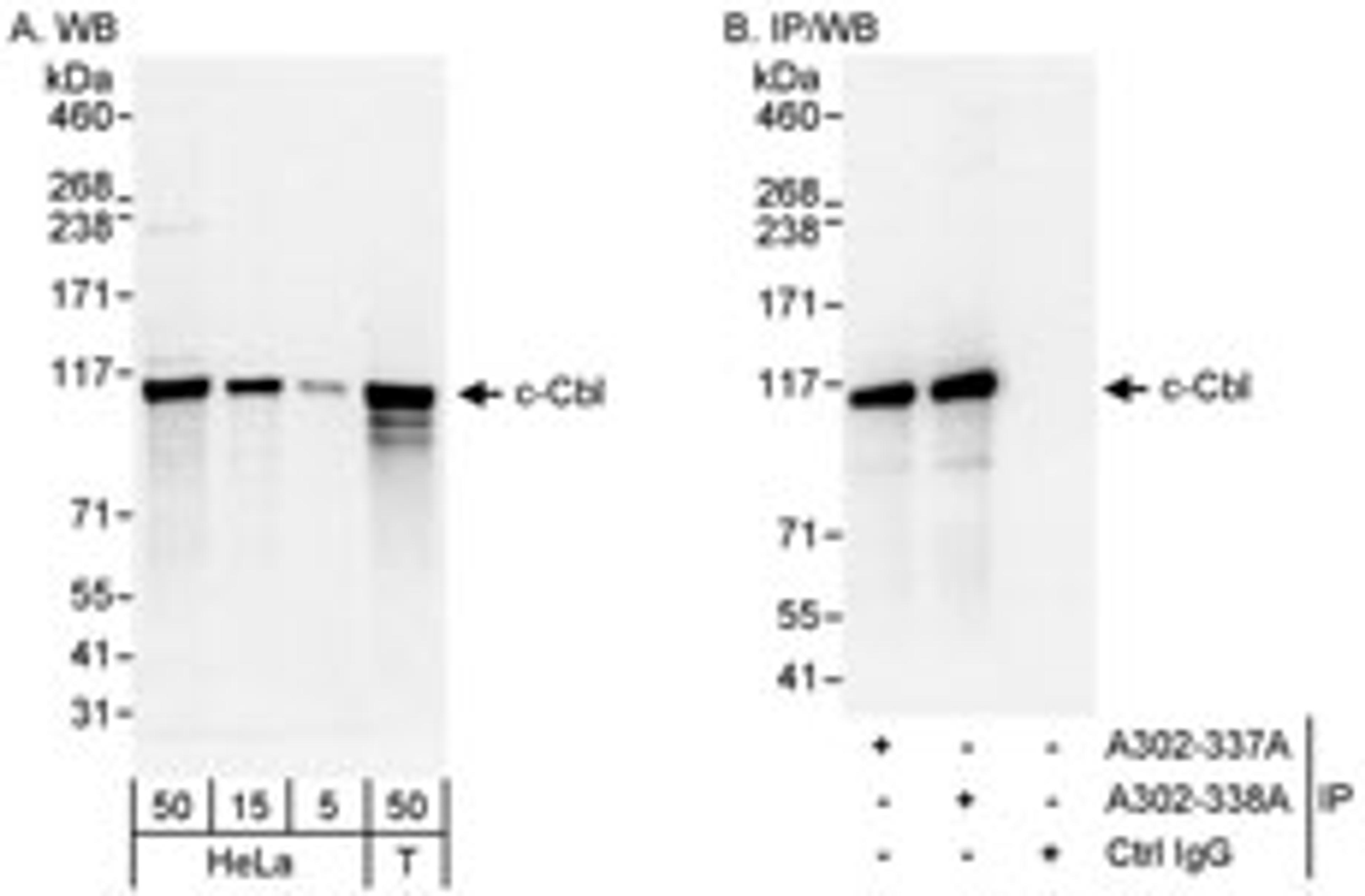 Detection of human c-Cbl by western blot and immunoprecipitation.