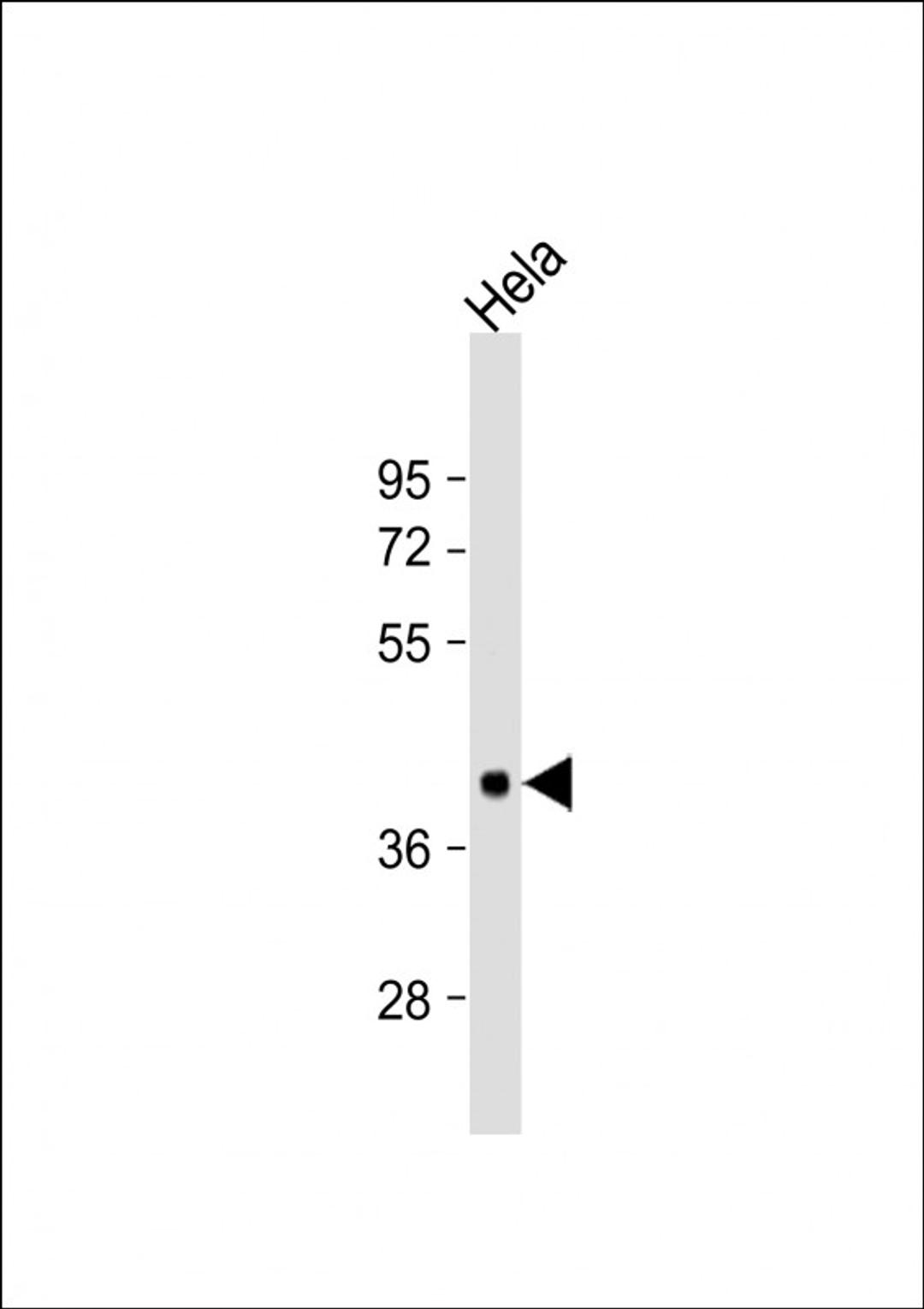 Western Blot at 1:1000 dilution + Hela whole cell lysate Lysates/proteins at 20 ug per lane.