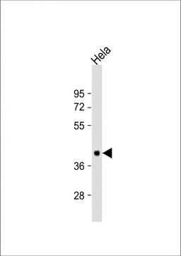 Western Blot at 1:1000 dilution + Hela whole cell lysate Lysates/proteins at 20 ug per lane.