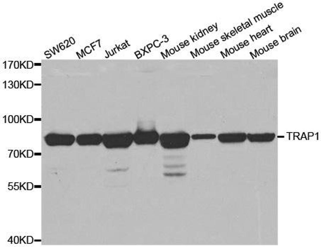 Western blot analysis of extracts of various cell lines using TRAP1 antibody