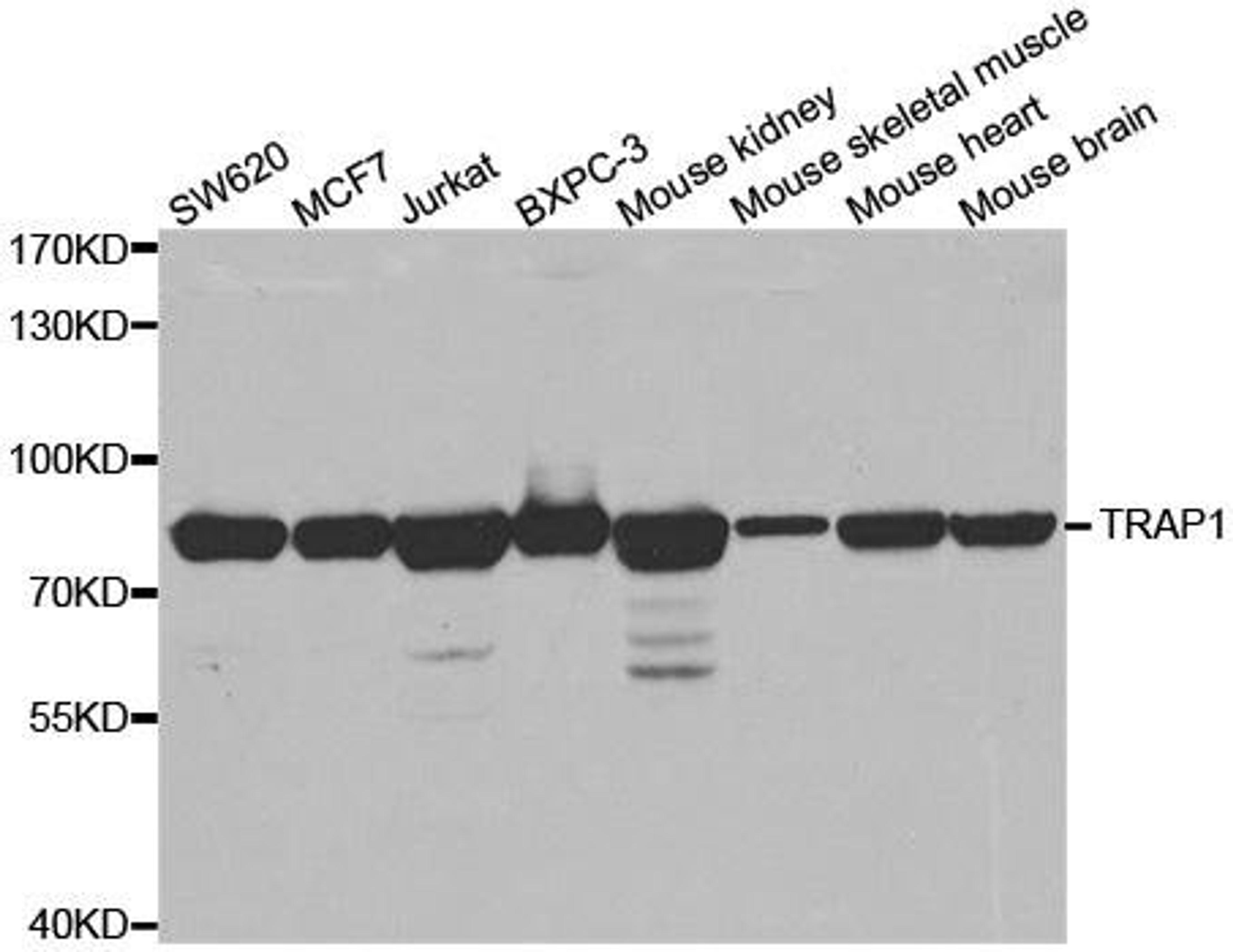 Western blot analysis of extracts of various cell lines using TRAP1 antibody