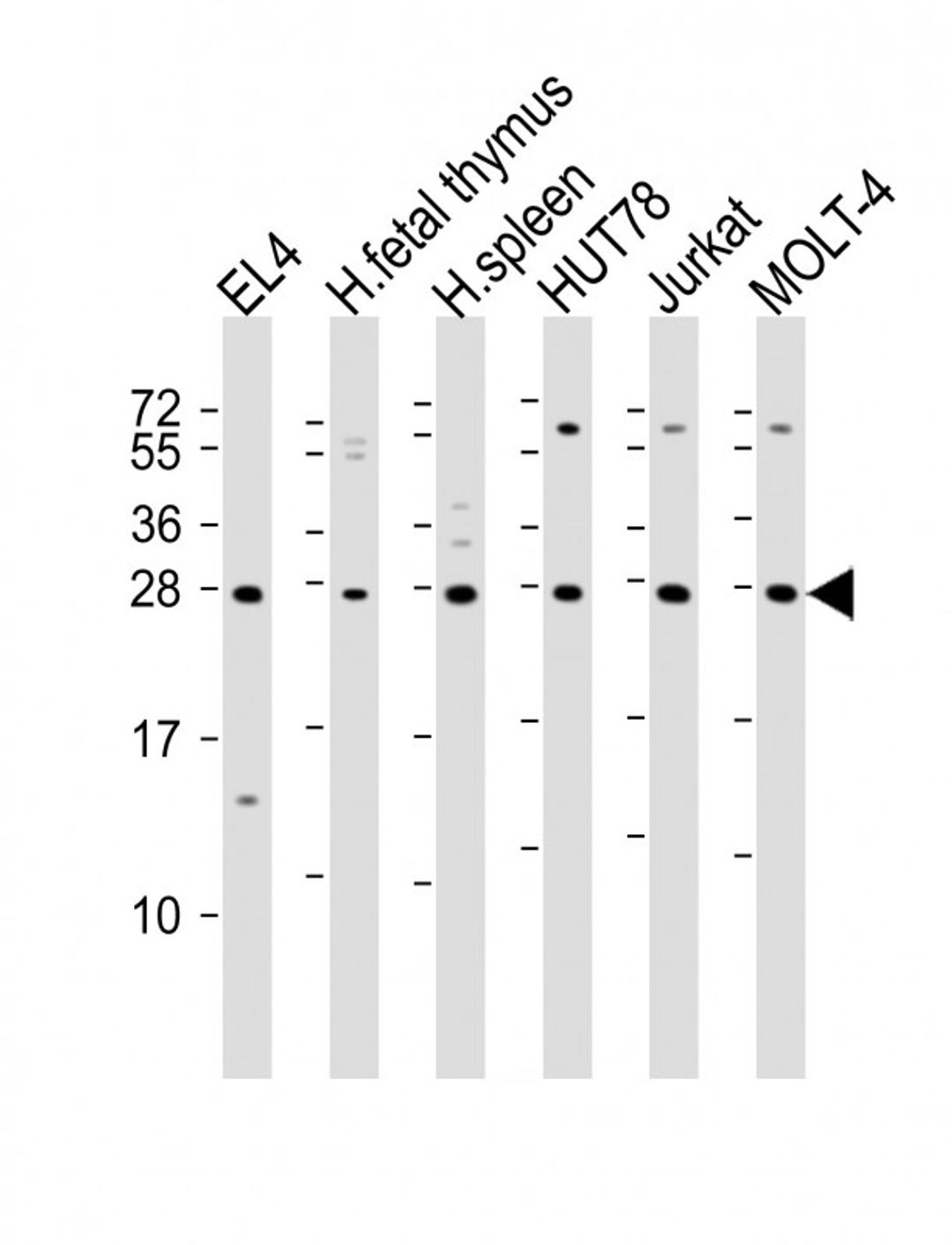 Western Blot at 1:2000 dilution Lane 1: EL4 whole cell lysate Lane 2: human fetal thymus lysate Lane 3: human spleen lysate Lane 4: HUT78 whole cell lysate Lane 5: Jurkat whole cell lysate Lane 6: MOLT-4 whole cell lysate Lysates/proteins at 20 ug per lan